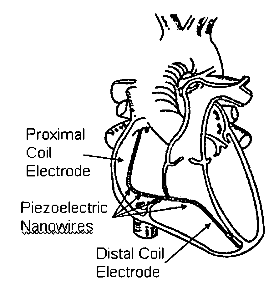 Cardiovascular power source for automatic implantable cardioverter defibrillators