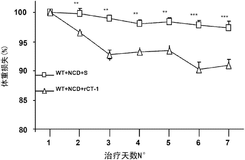 Use of cardiotrophin- 1 for the treatment of metabolic diseases