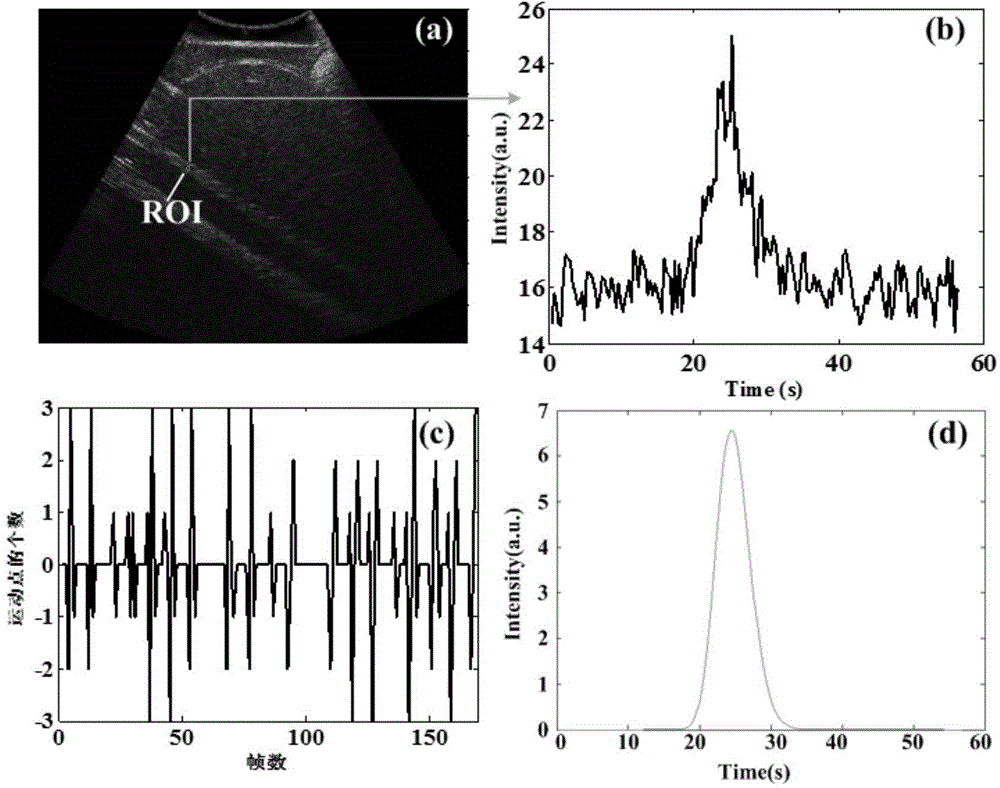 Respiratory motion compensation and bimodal fitting method for time intensity curve