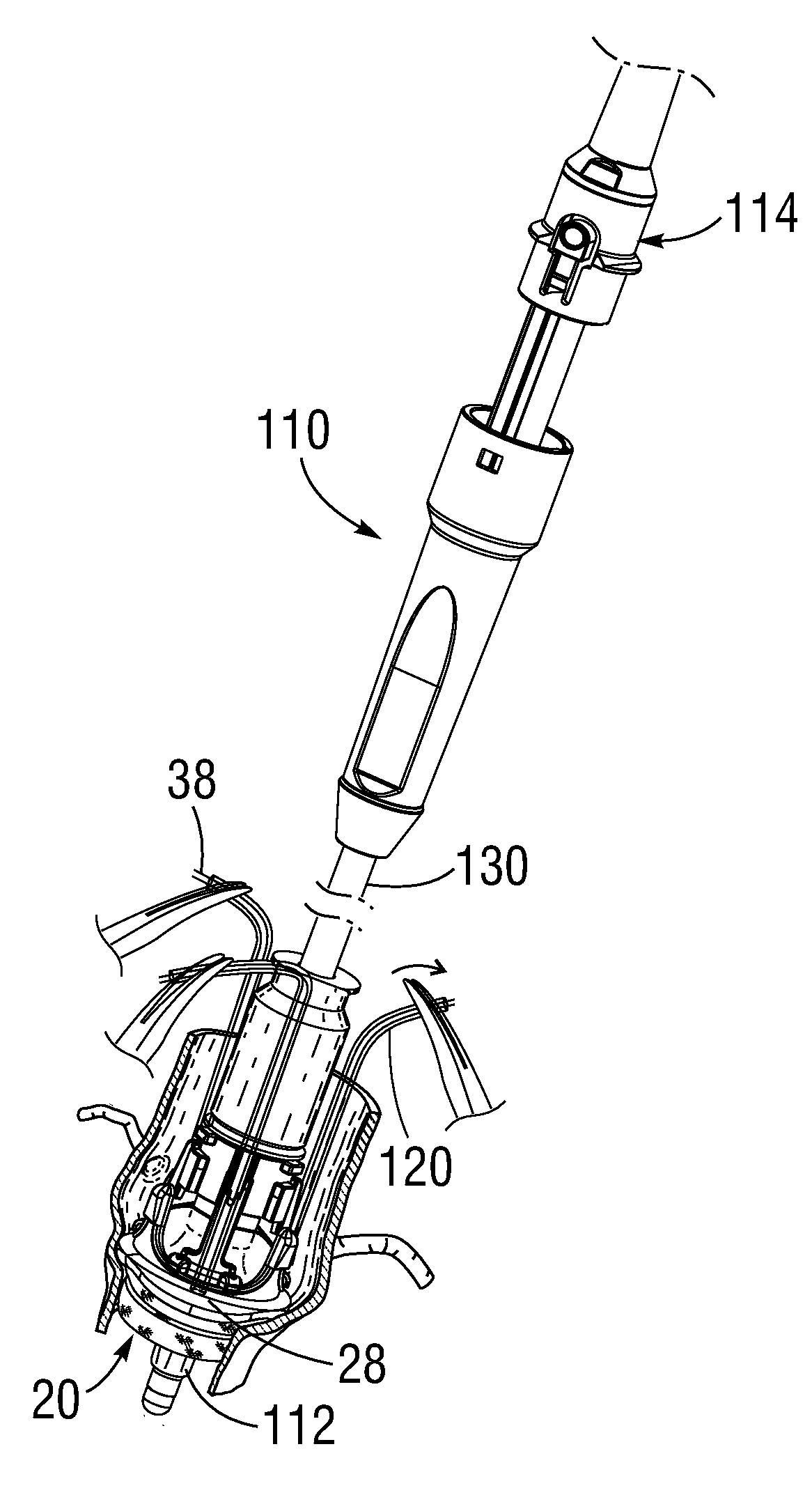 Systems and methods for ensuring safe and rapid deployment of prosthetic heart valves