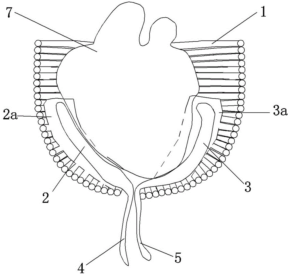 Heart auxiliary device