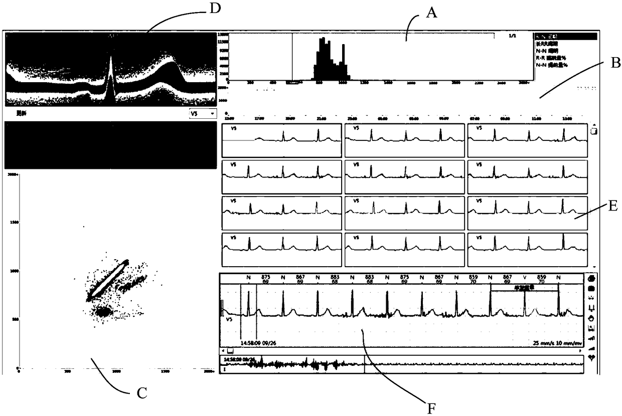Method and device for analyzing electrocardiogram waveform, terminal and computer-readable storage medium
