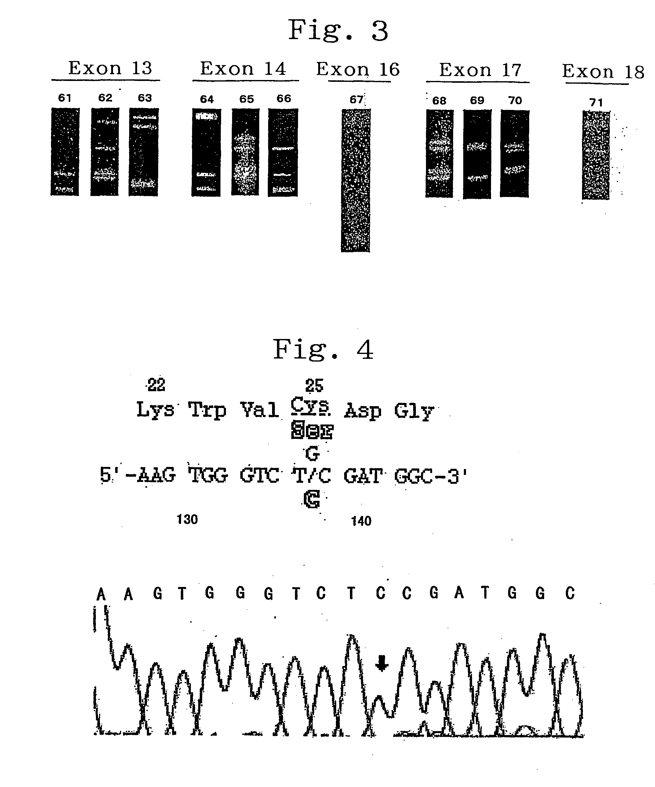 Method of detecting lipid metabolic errors