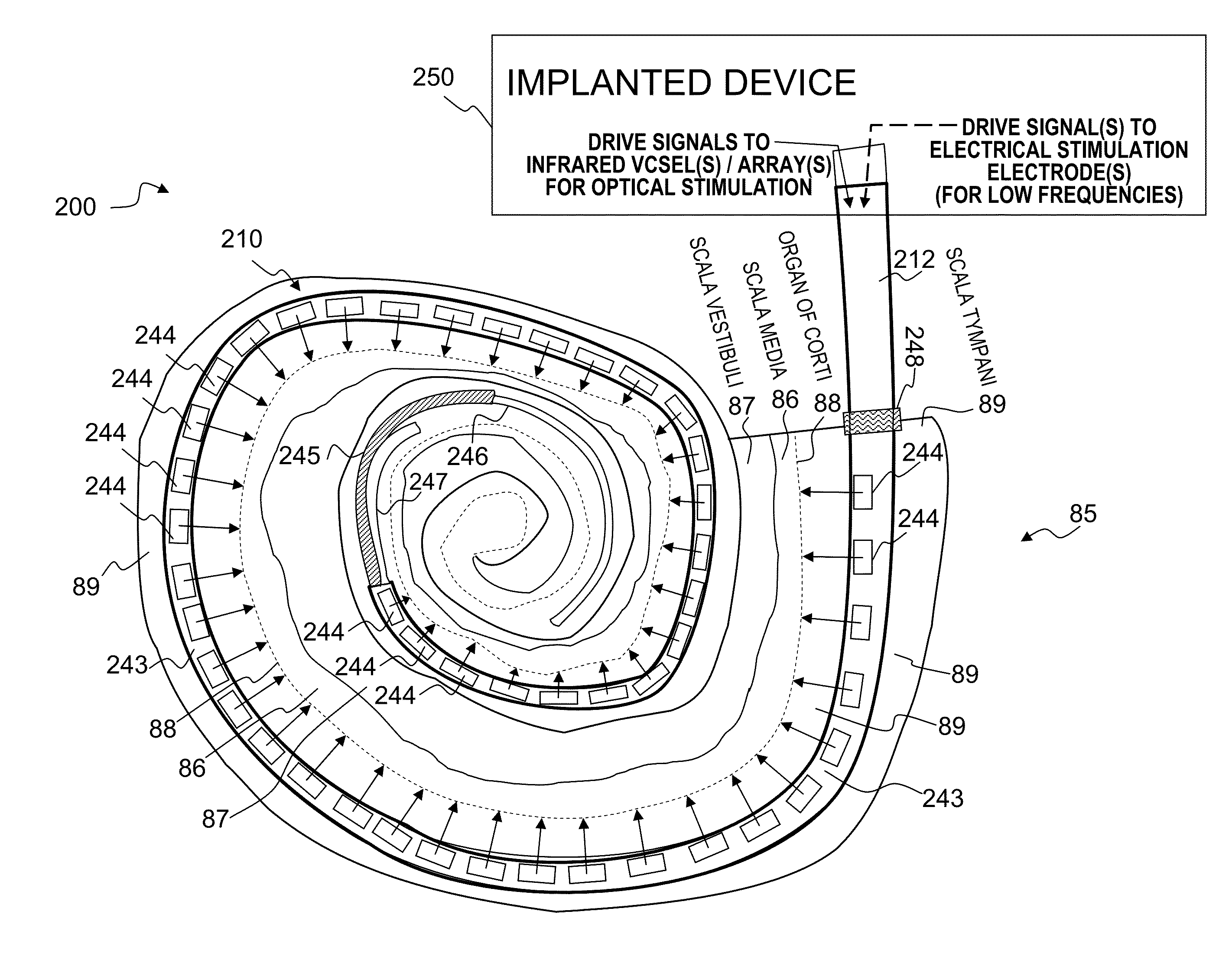 Optical-stimulation cochlear implant with electrode(s) at the apical end for electrical stimulation of apical spiral ganglion cells of the cochlea