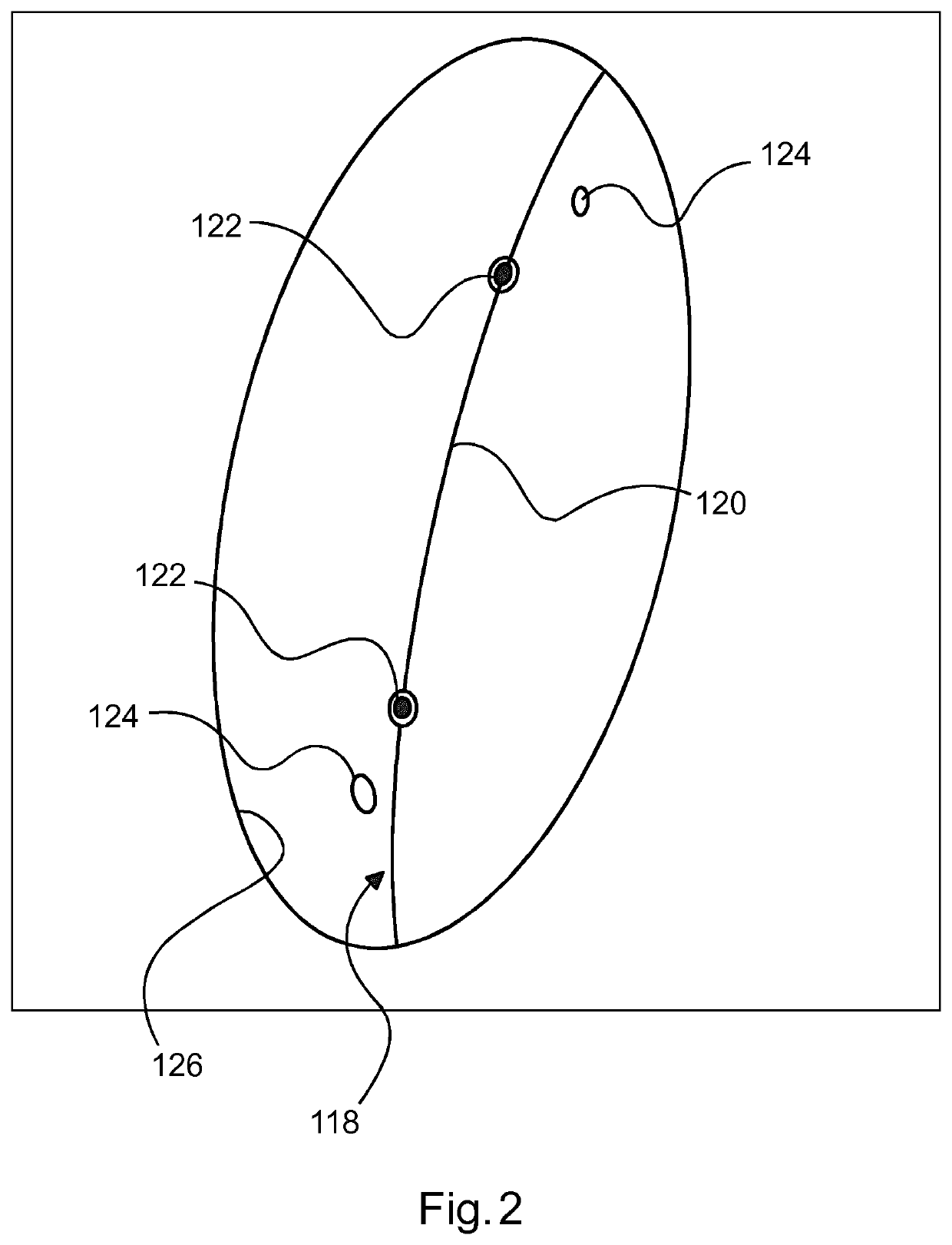 Stent positioning