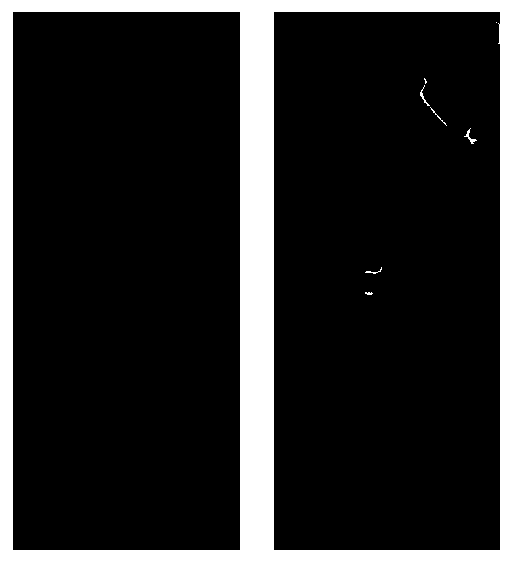 NLM filtering finger vein denoising method based on skin crack segmentation