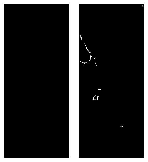 NLM filtering finger vein denoising method based on skin crack segmentation