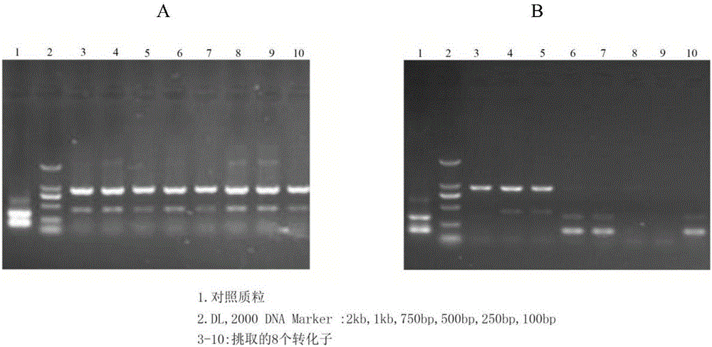 Application of transcription factor Fo x O3 in preparing cerebral ischemia reperfusion nerve injury drug