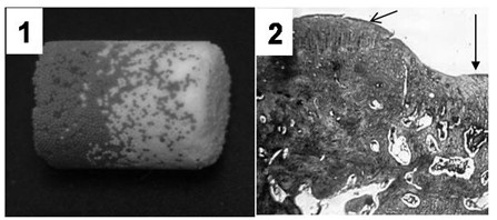 Poly(lactic-co-glycolic acid)-based growth factor gradient release microsphere stent as well as preparation method and application thereof