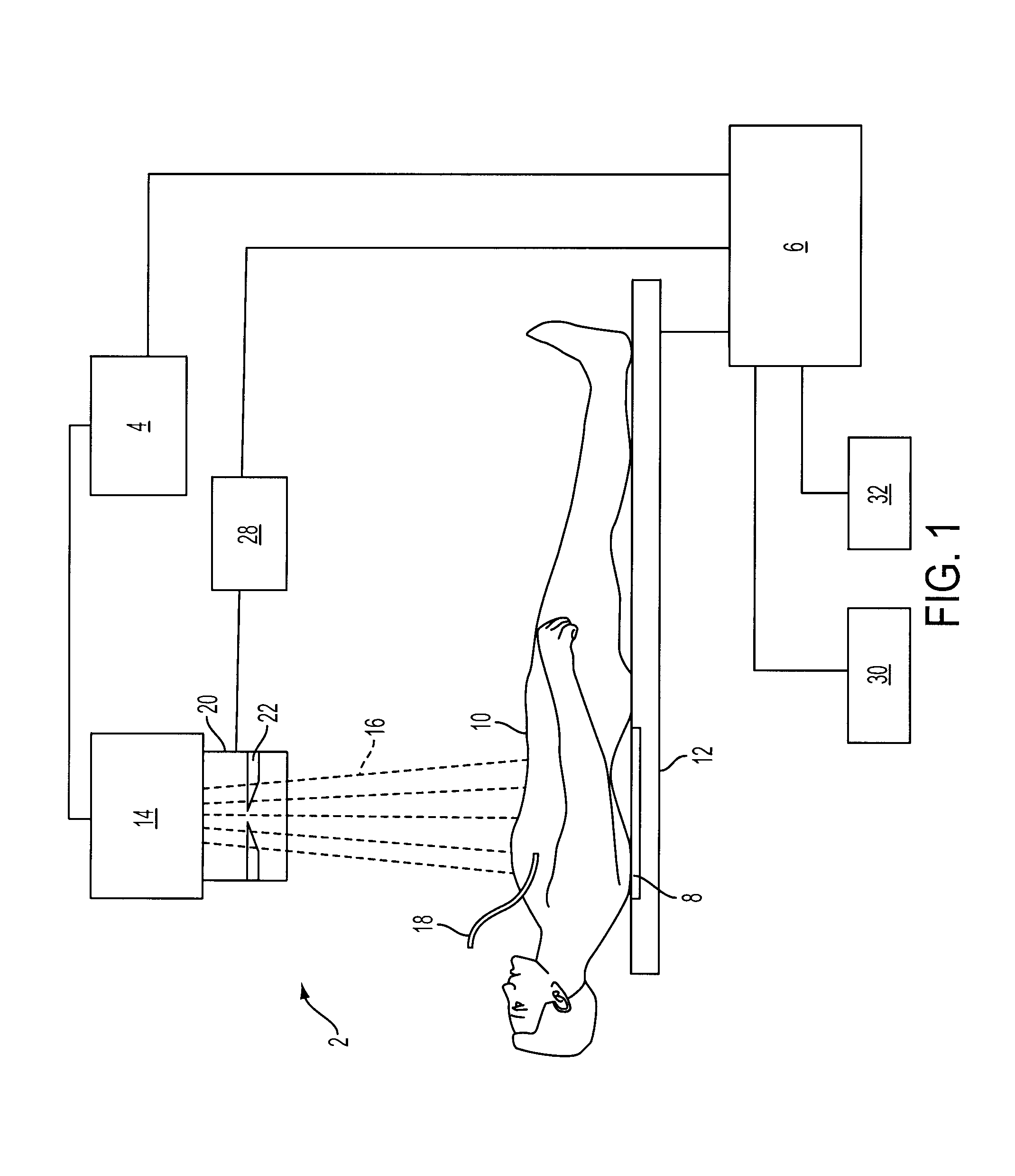 Histogram Calculation for Auto-Windowing of Collimated X-Ray Image