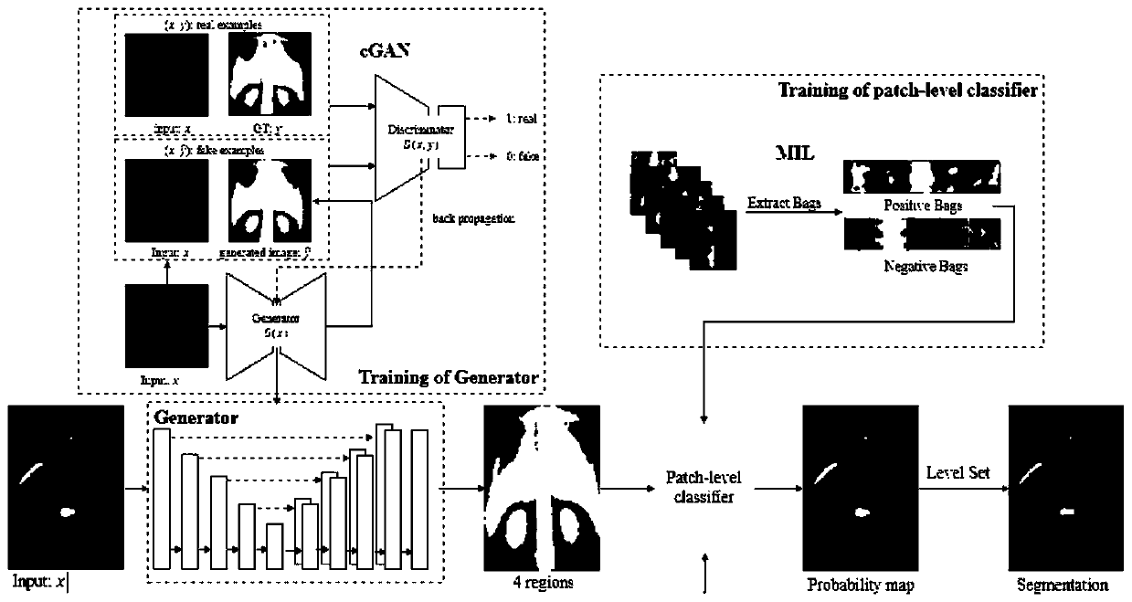 Bone scanning image hotspot segmentation method and system, medium and equipment