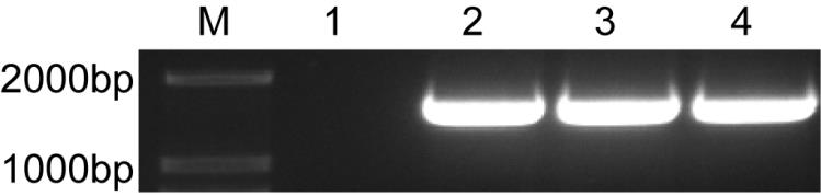 A kind of preparation method and application of human hematopoietic progenitor cells with B lineage differentiation potential