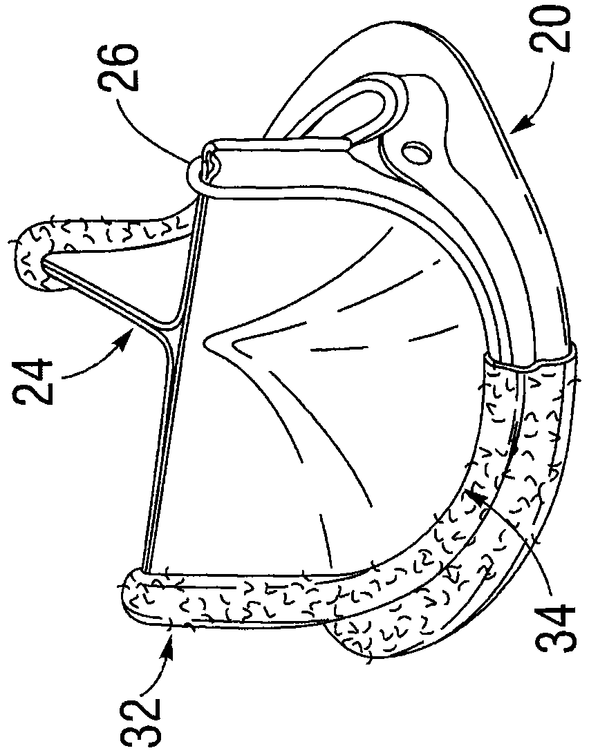 Surgical heart valve recognizable after implantation