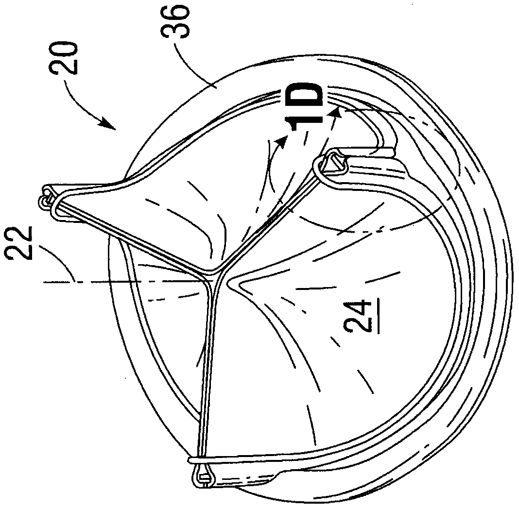 Surgical heart valve recognizable after implantation