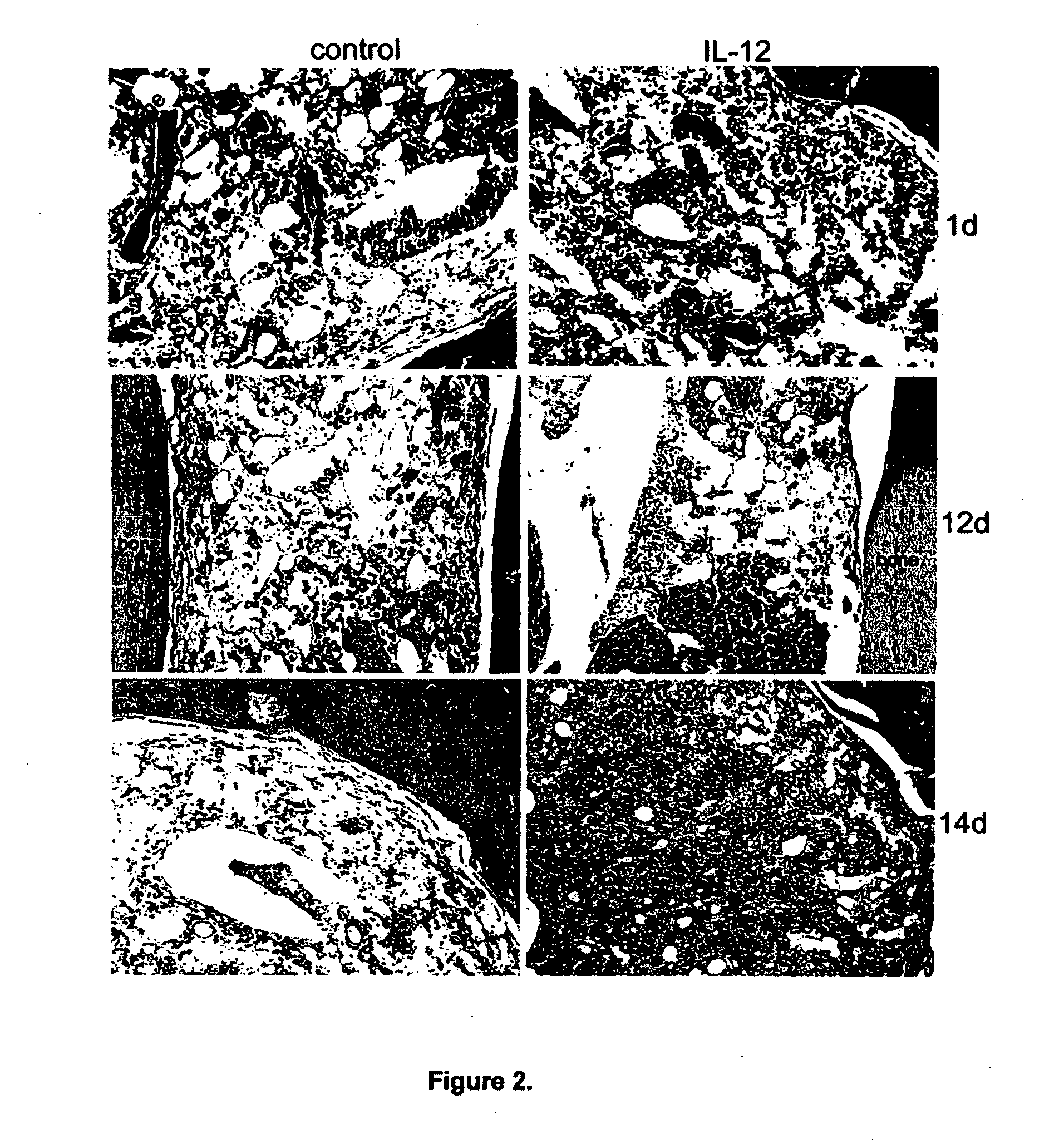 Method for bone marrow preservation or recovery