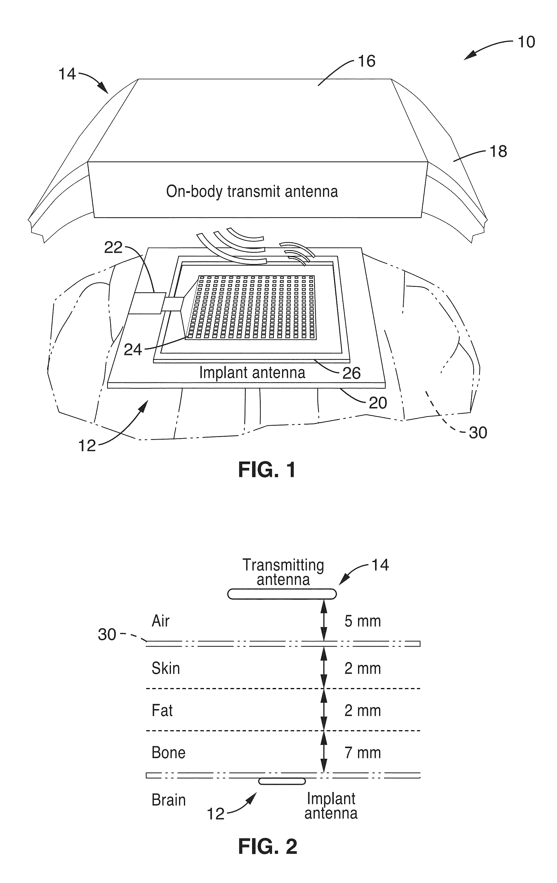 Monolithically integrated implantable flexible antenna for electrocorticography and related biotelemetry devices