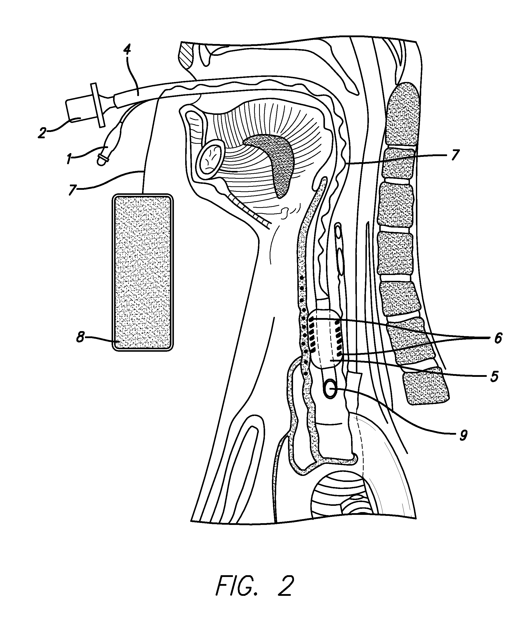 System and method for imaging endotracheal tube placement and measuring airway occlusion cuff pressure