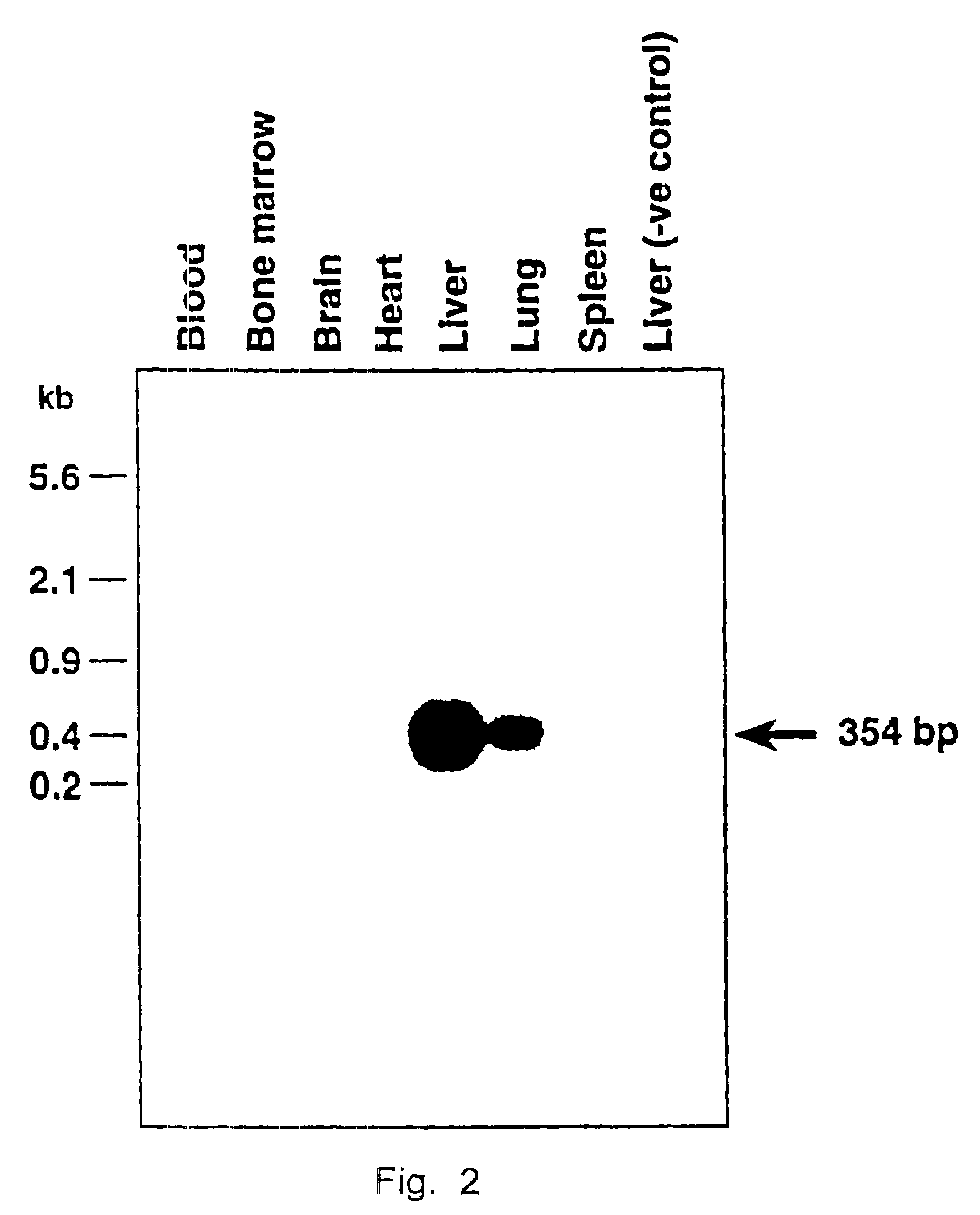 AAV vectors