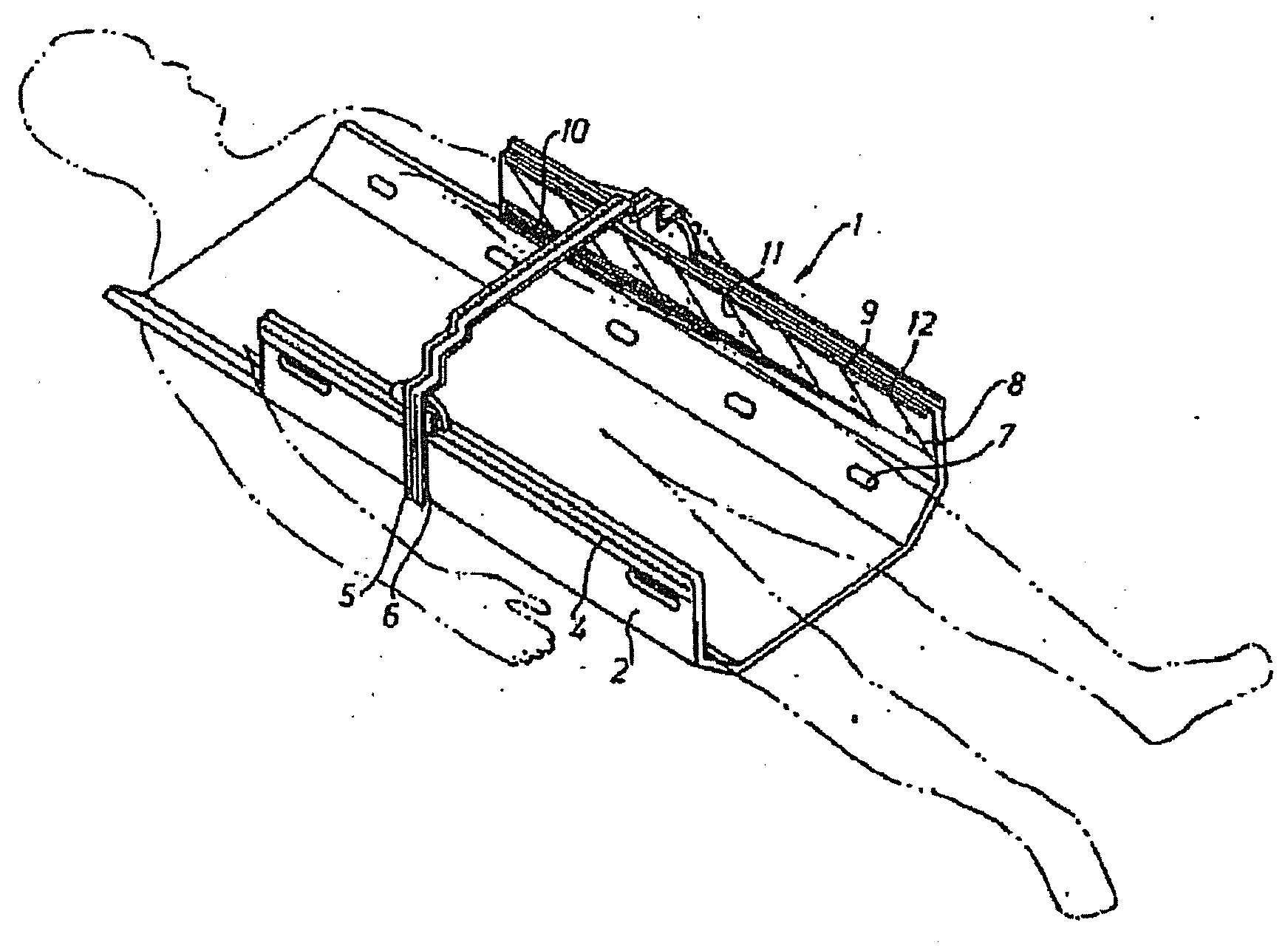 Respiration monitoring