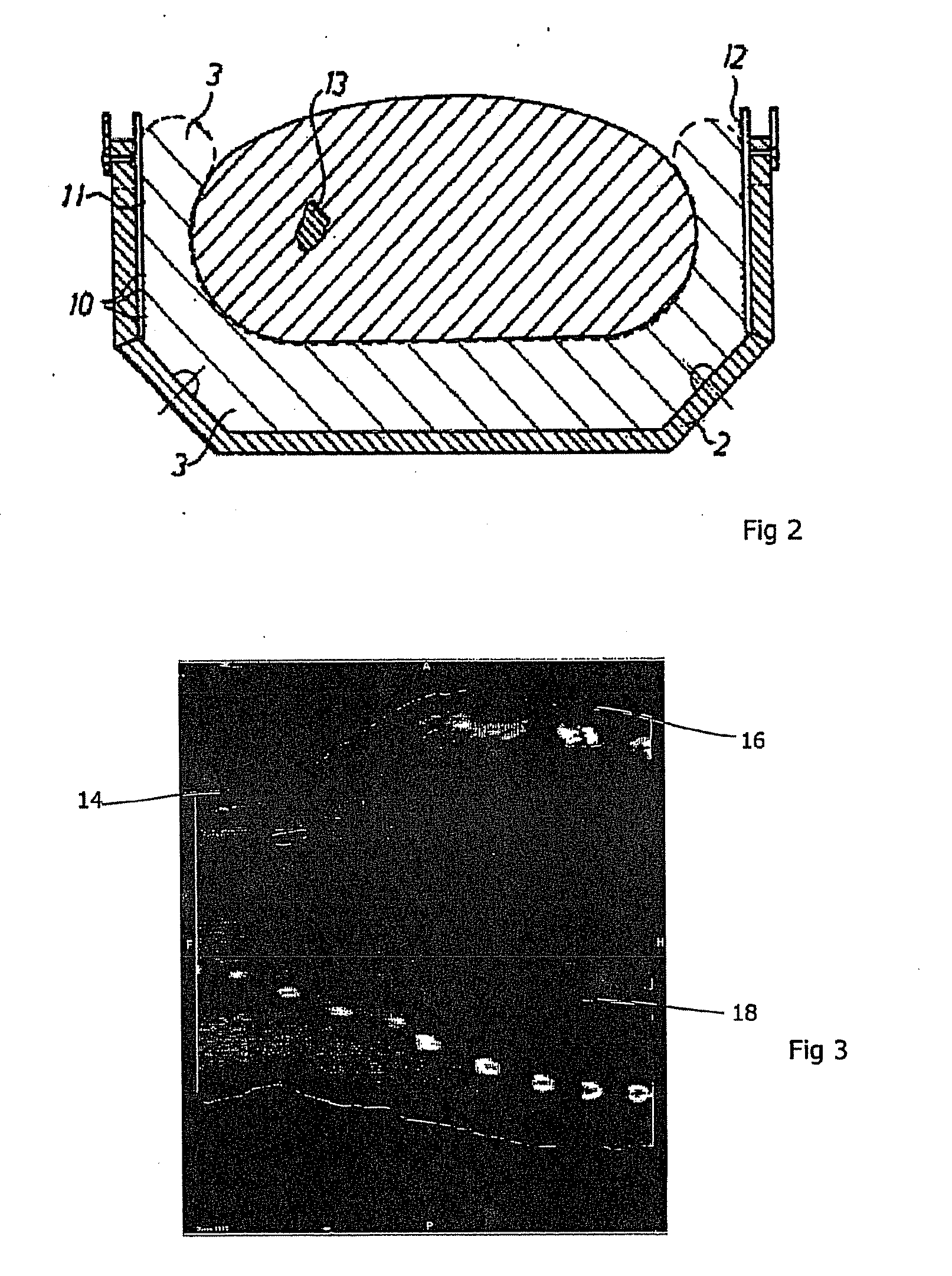 Respiration monitoring