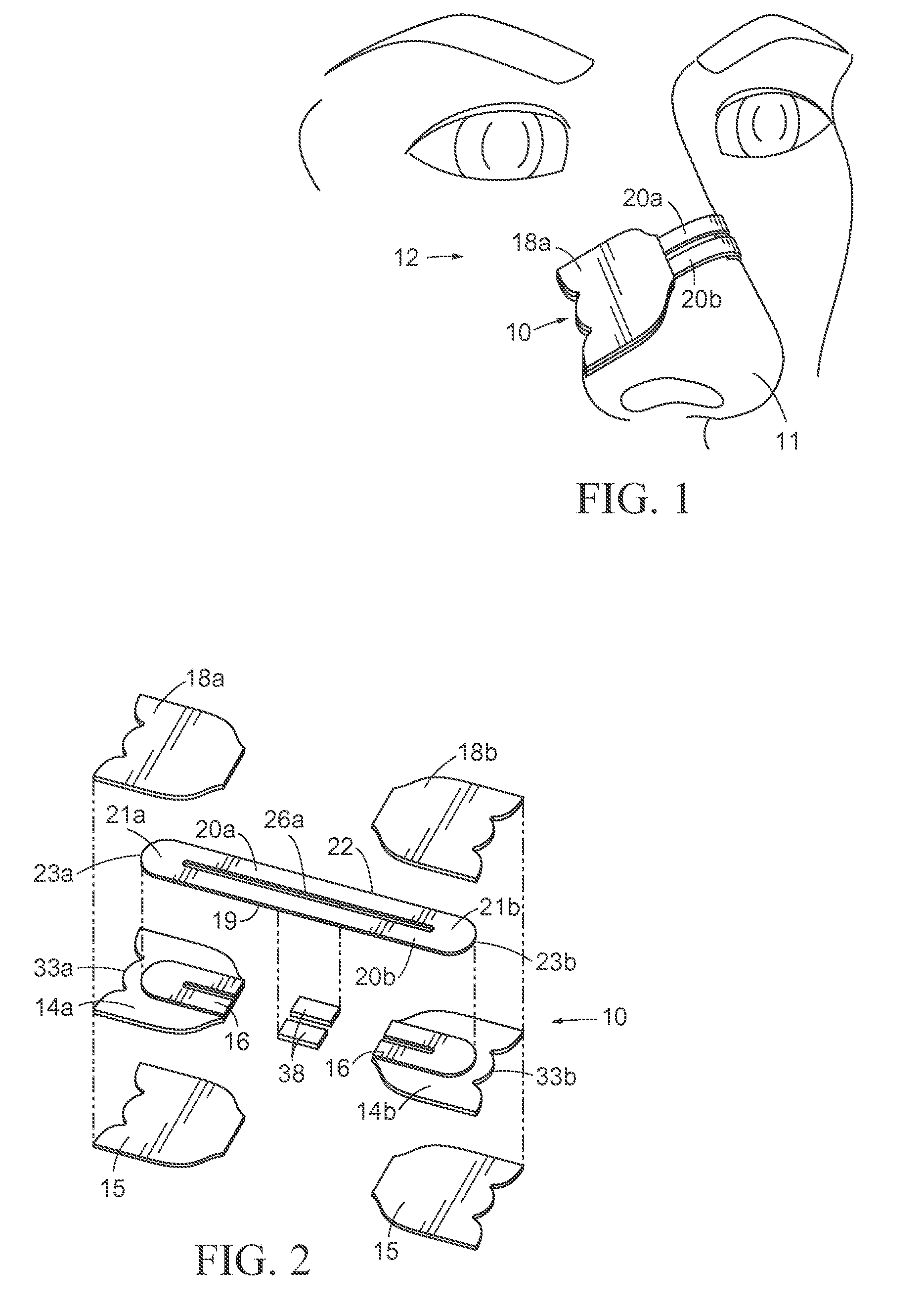 Economical Nasal Dilator and Method of Manufacture