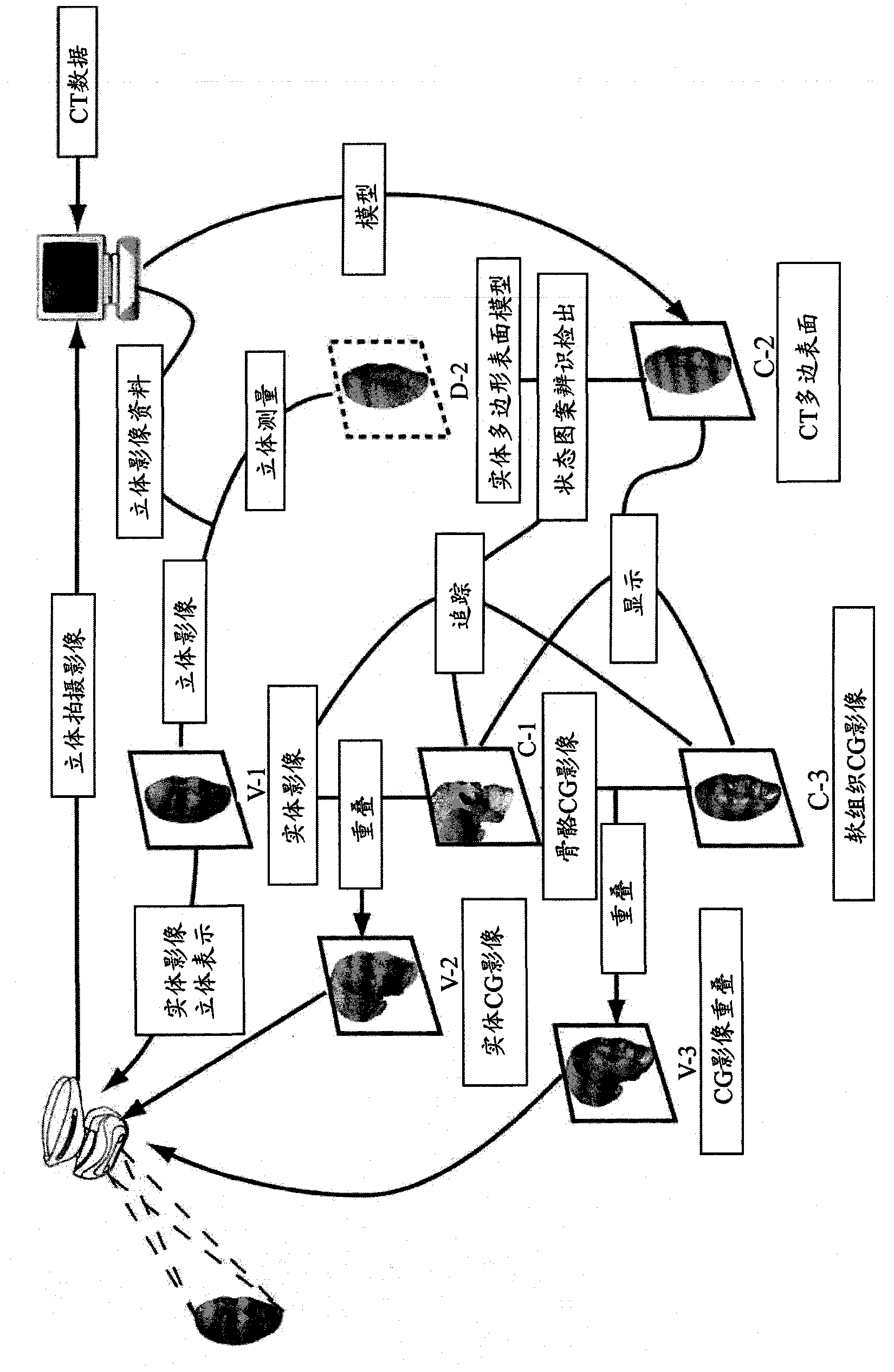 Three-dimensional digital magnifier operation supporting system