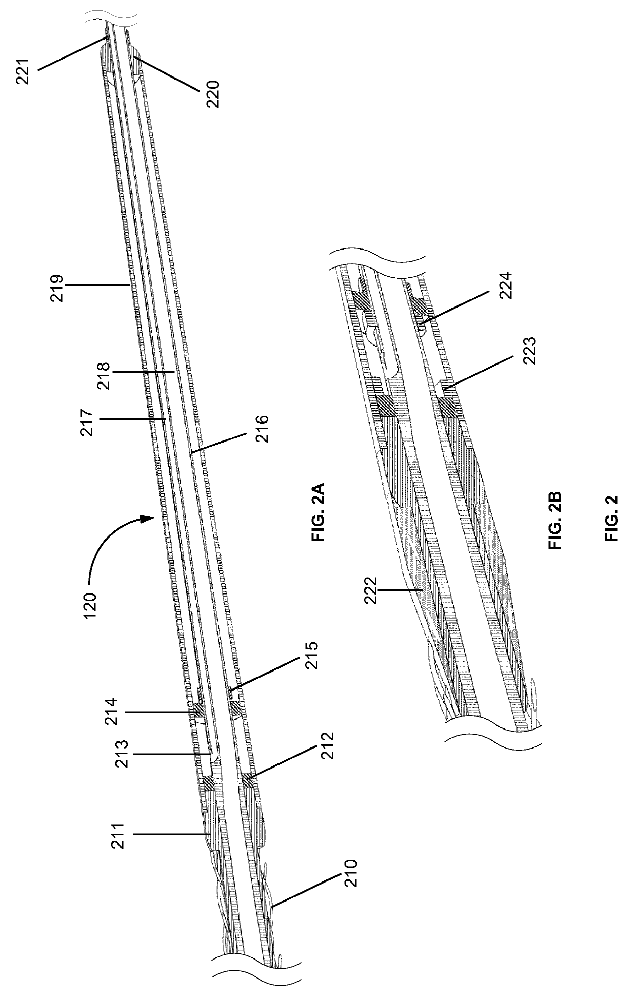 Catheter system for treating vascular and non-vascular diseases