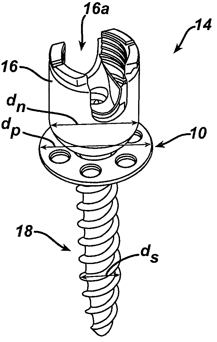 Unilateral placement