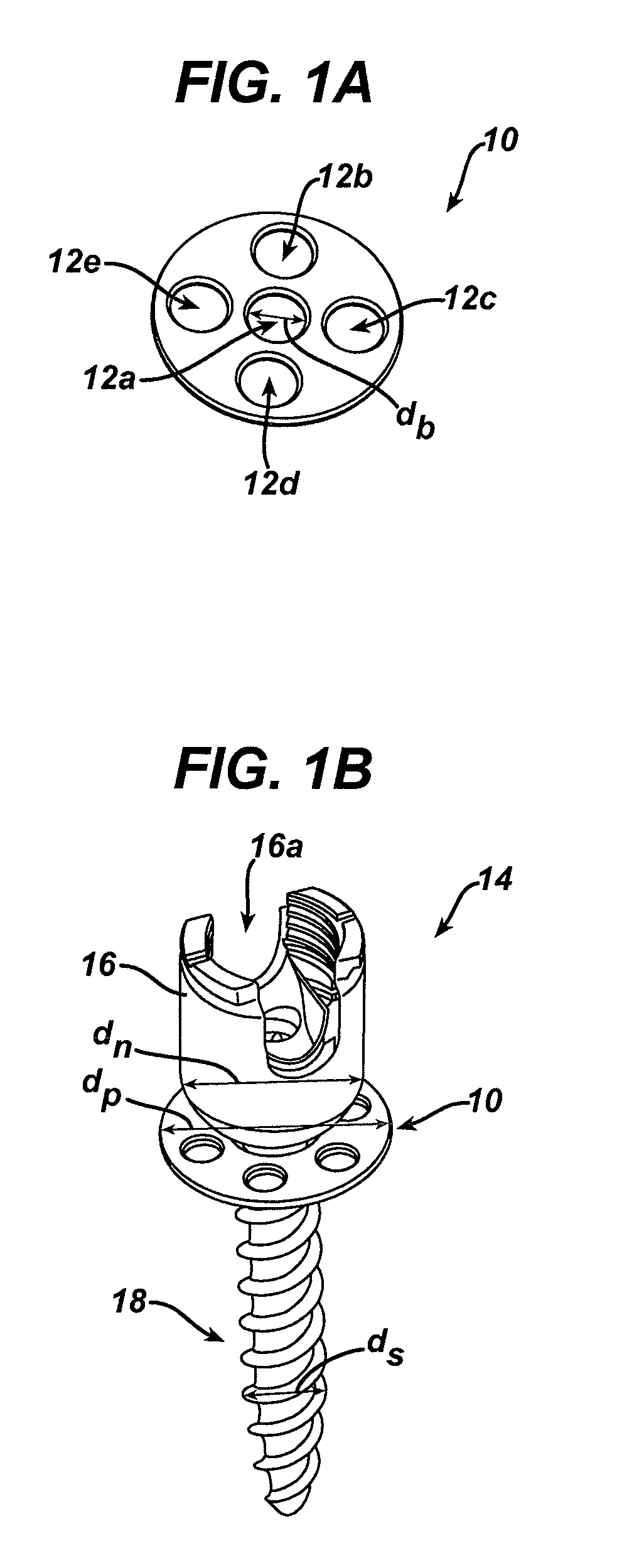 Unilateral placement