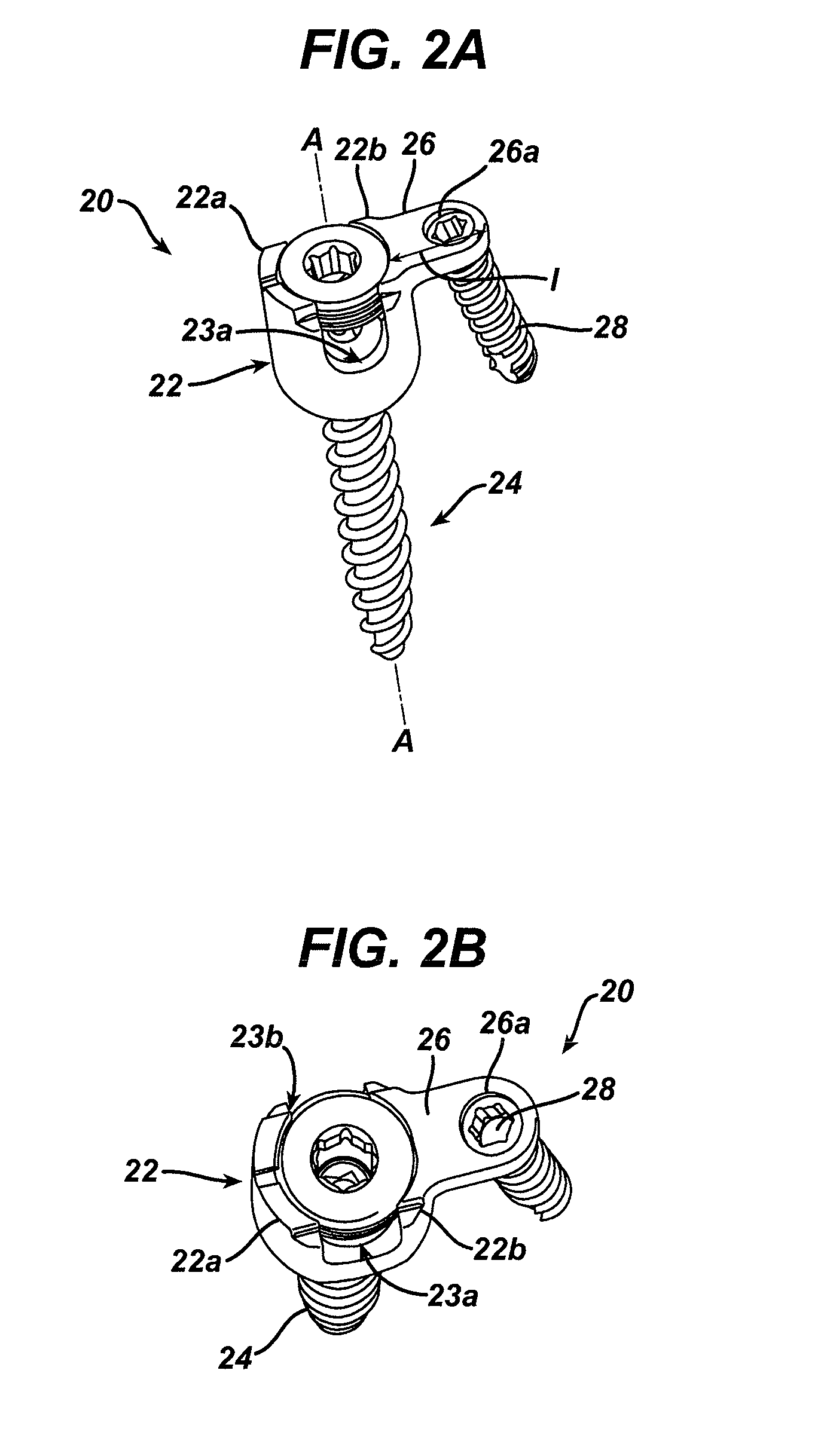 Unilateral placement