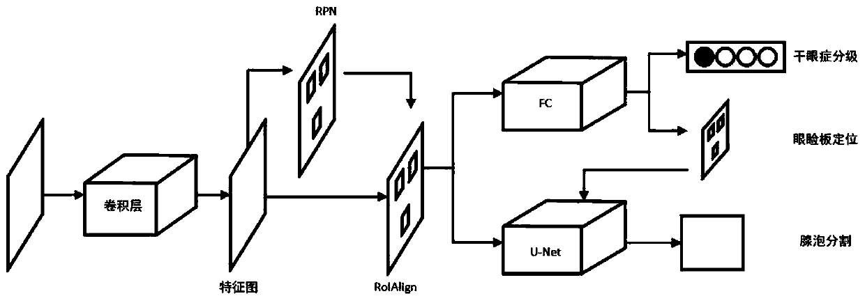 Xerophthalmia grading evaluation system based on regional adaptive multi-task neural network