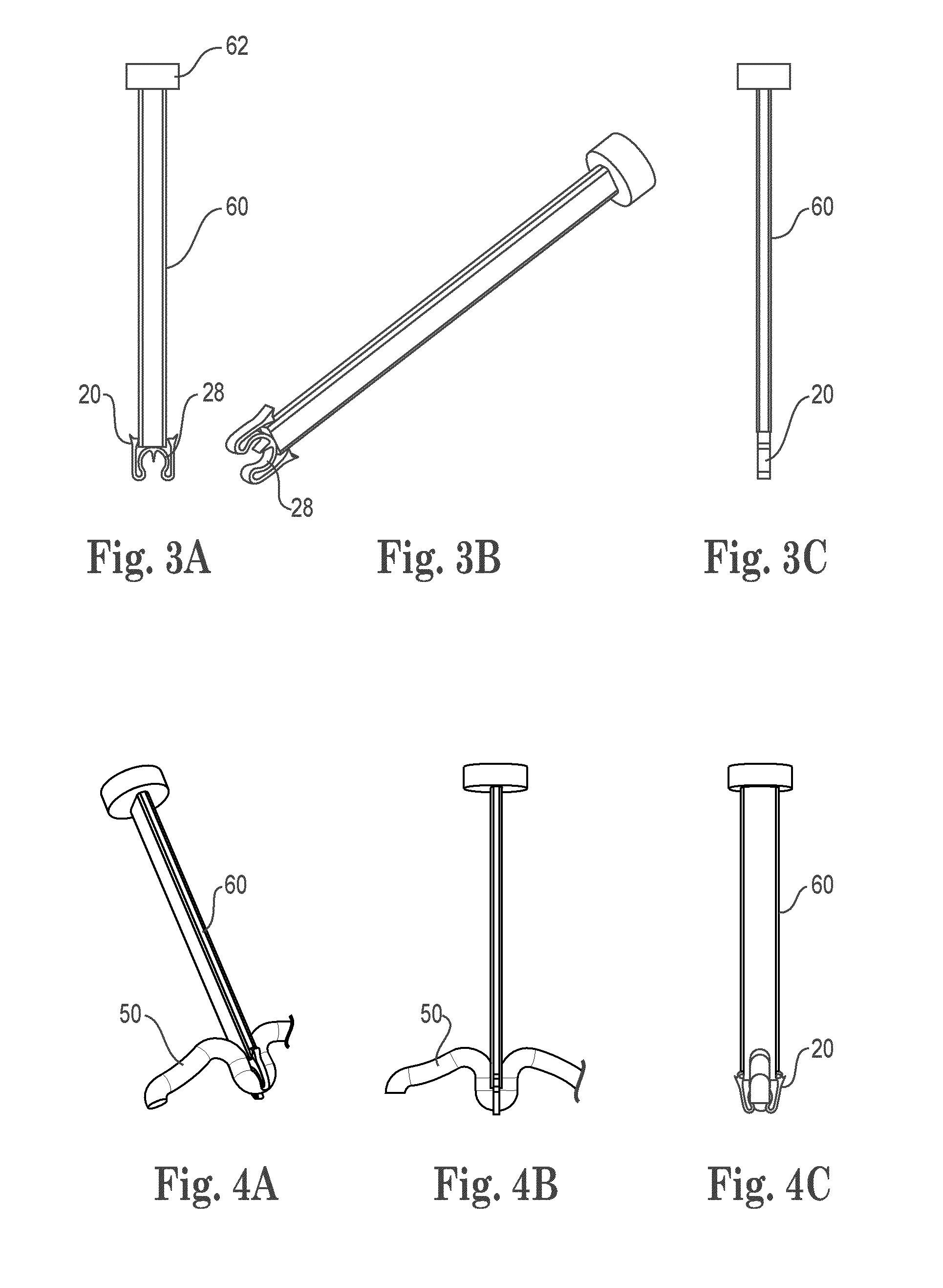 Tissue fixation system with single component anchor