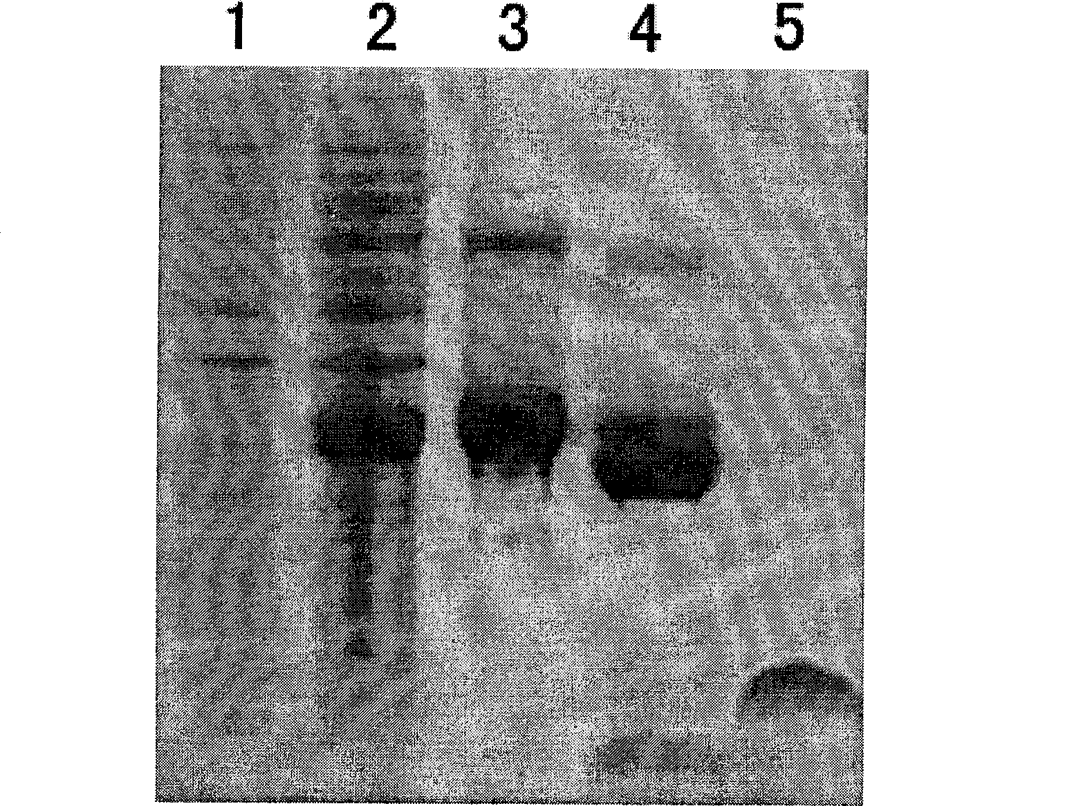 Use of scorpion source immunoloregulation polypeptide in preparing medicine for treating rheumatoid arthritis