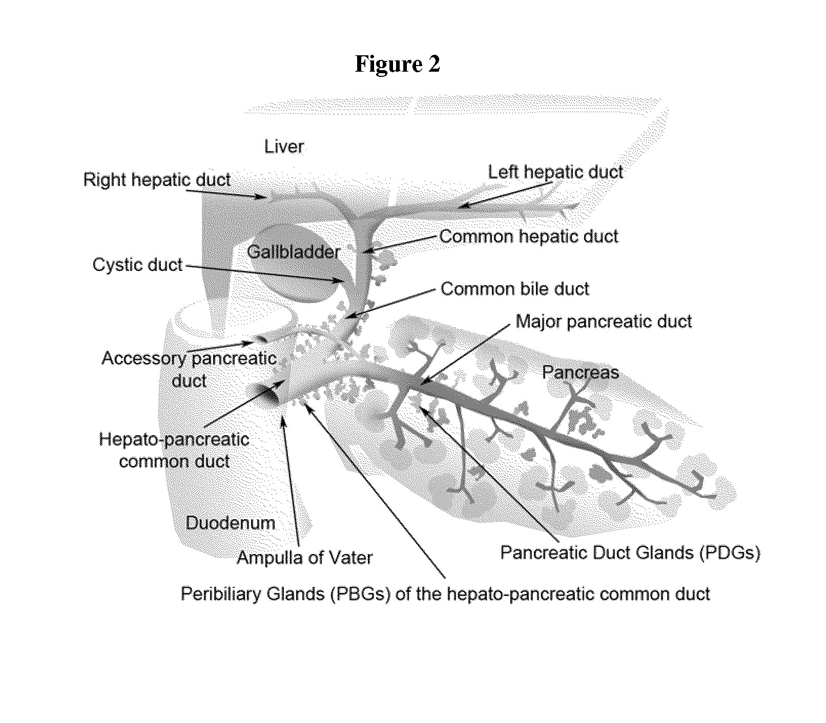 Method of treating pancreatic and liver conditions by endoscopic-mediated (or laparoscopic-mediated) transplantation of stem cells into/onto bile duct walls of particular regions of the biliary tree