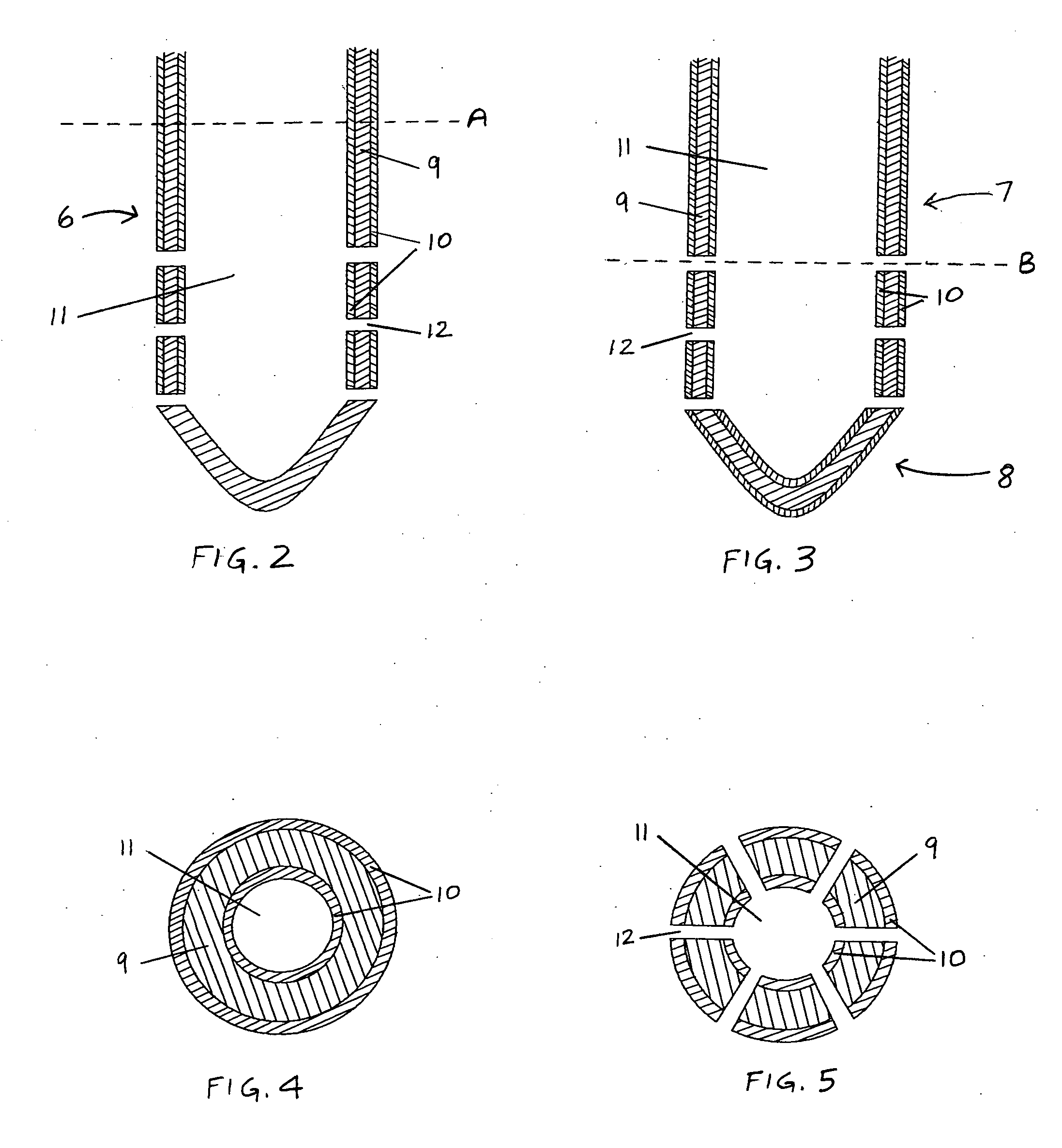 Central nervous system ultrasonic drain