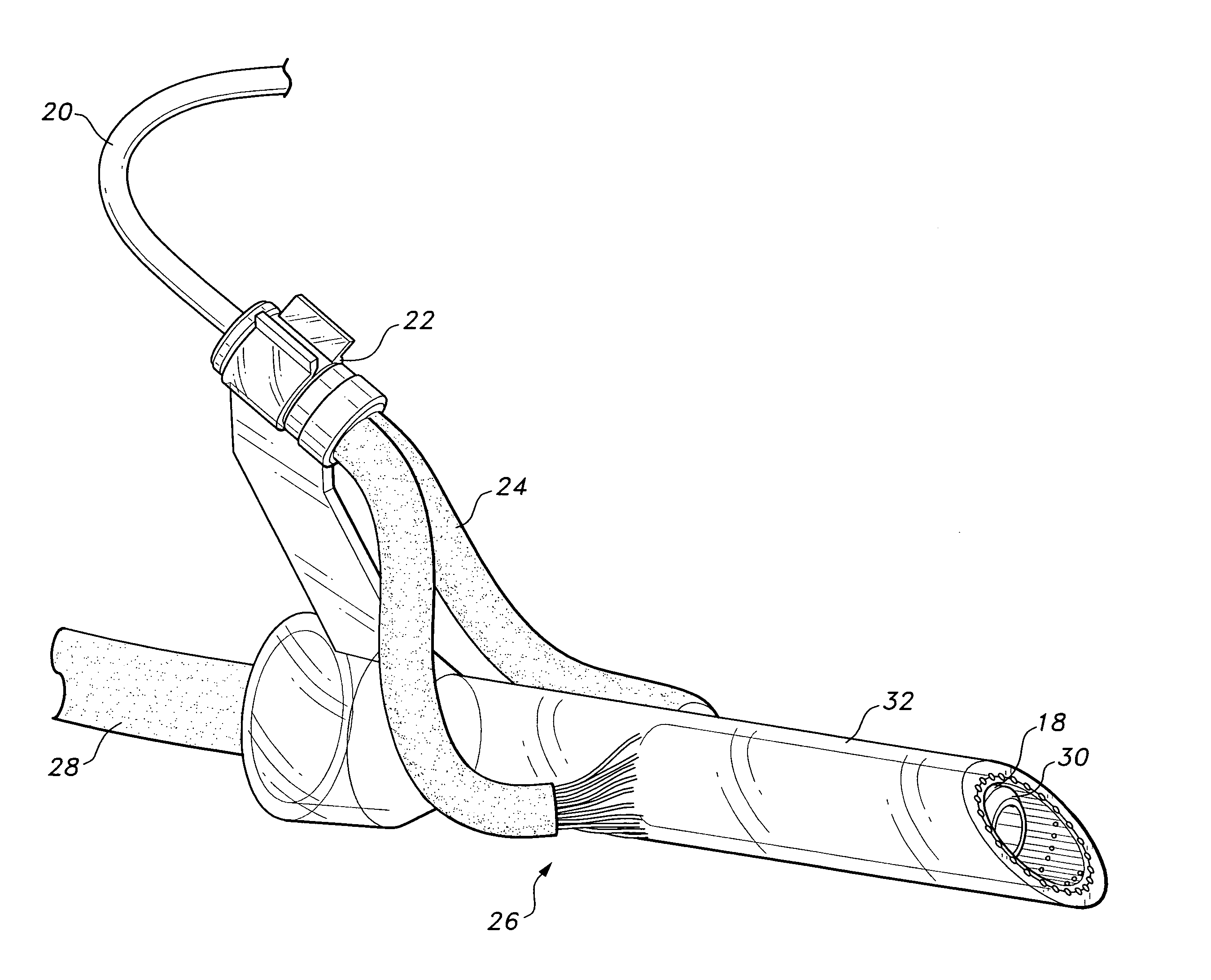 Self-cleaning and sterilizing endotracheal and tracheostomy tube