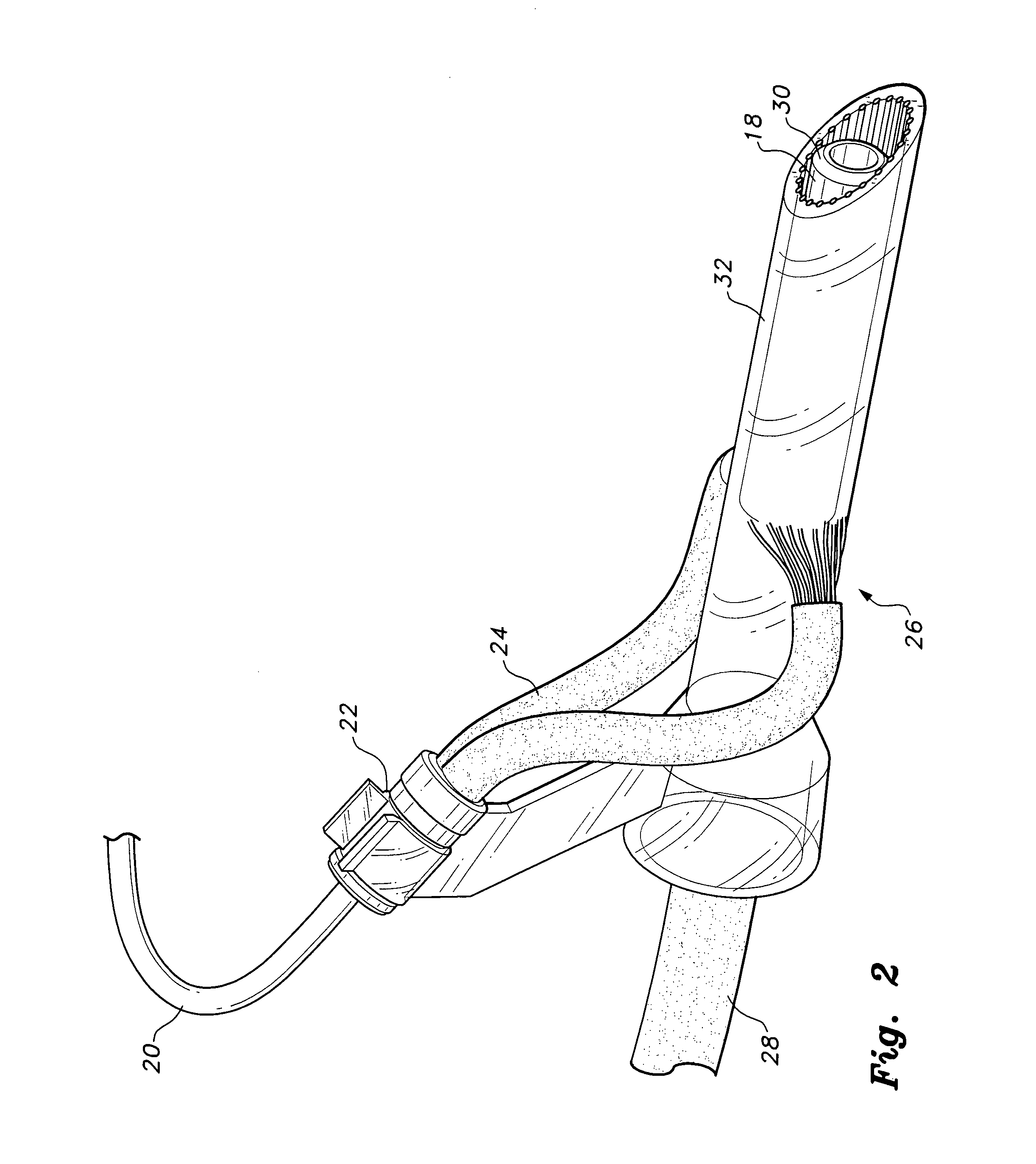 Self-cleaning and sterilizing endotracheal and tracheostomy tube