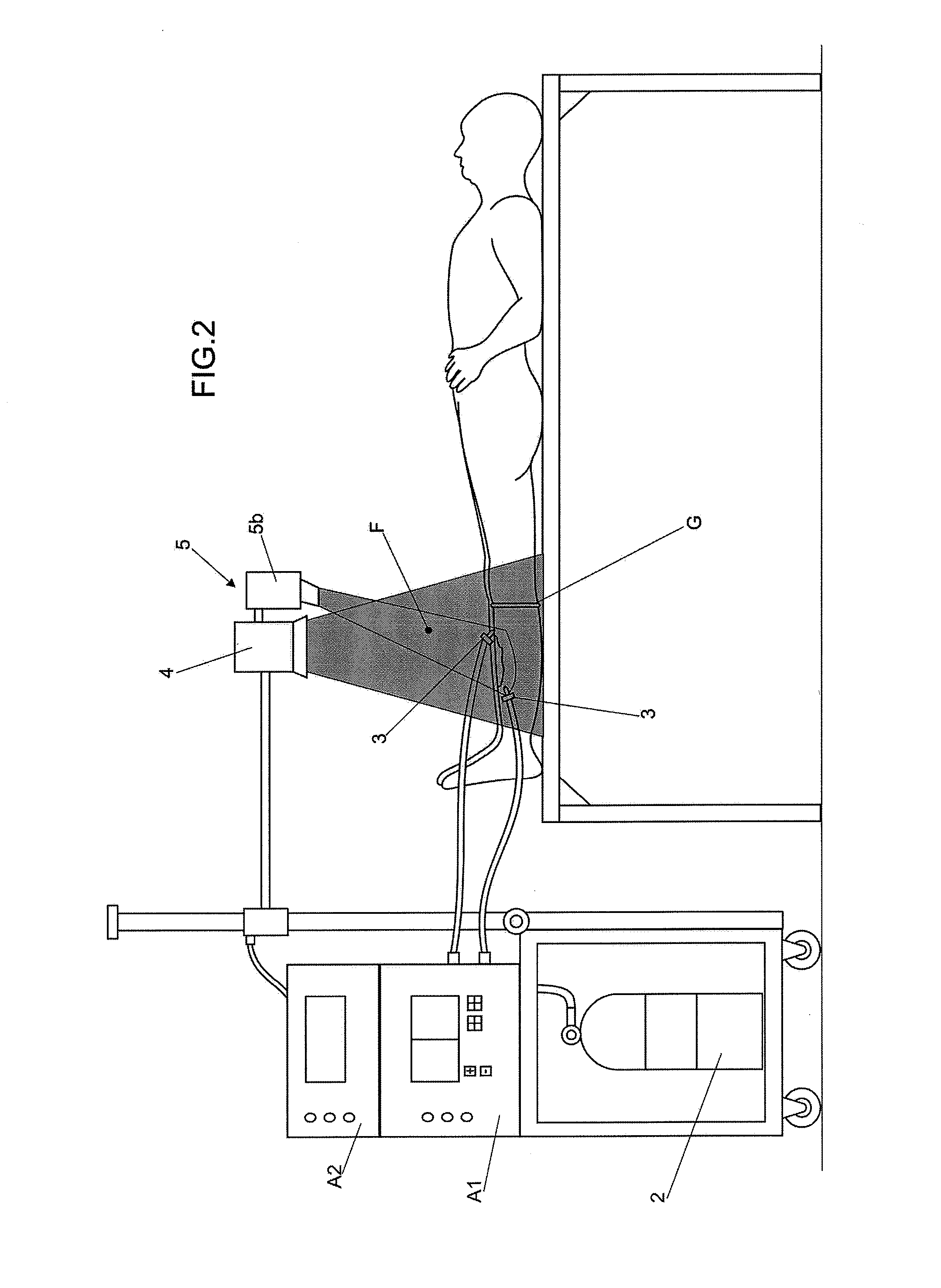 Method and apparatus that associate the parenteral injection of medical grade carbon dioxide (CO2) concomitantly with the application of infrared radiation from thermal and/or light sources using control by means of cutaneous and/or body thermometry