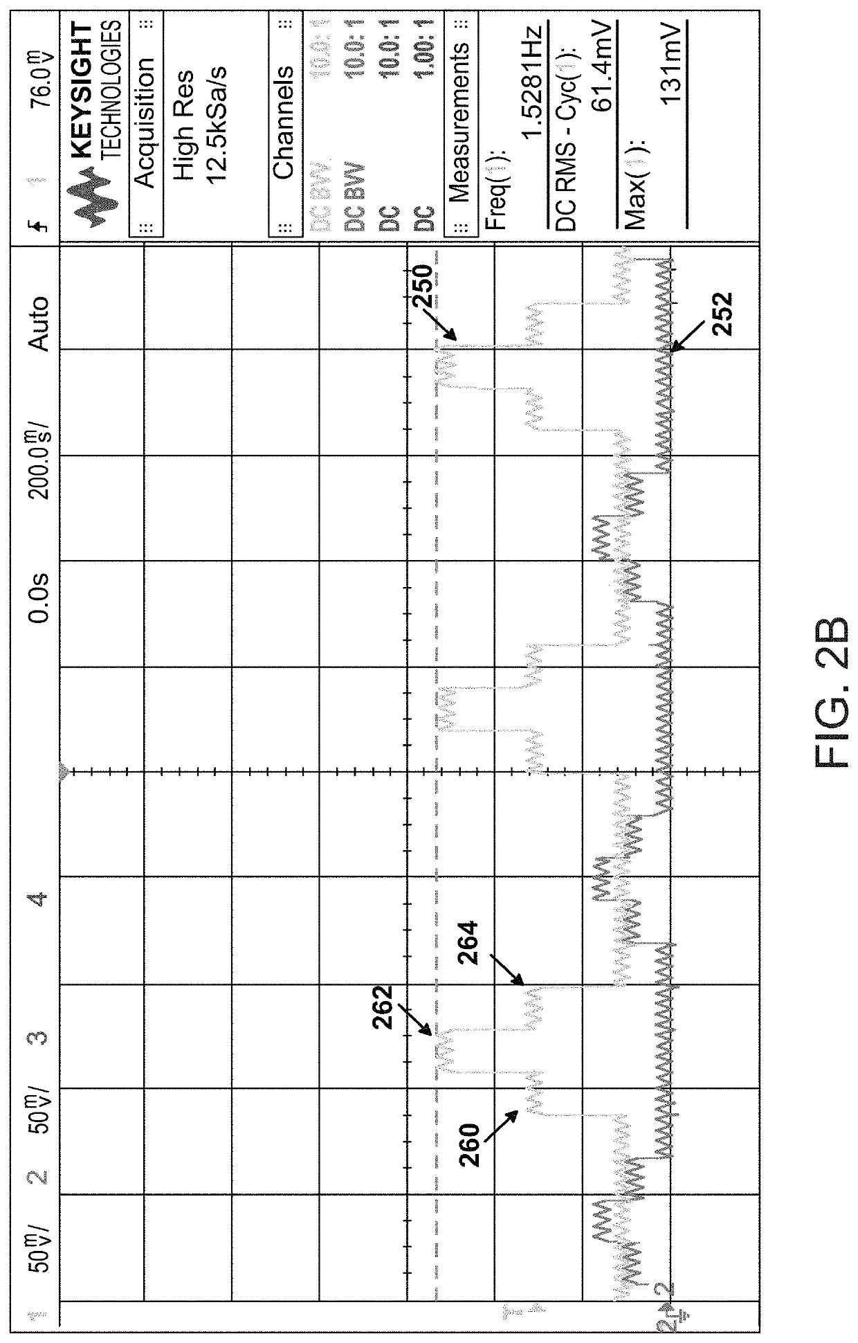 Intense pulse light (IPL) apparatus utilizing a pulse forming network (PFN)