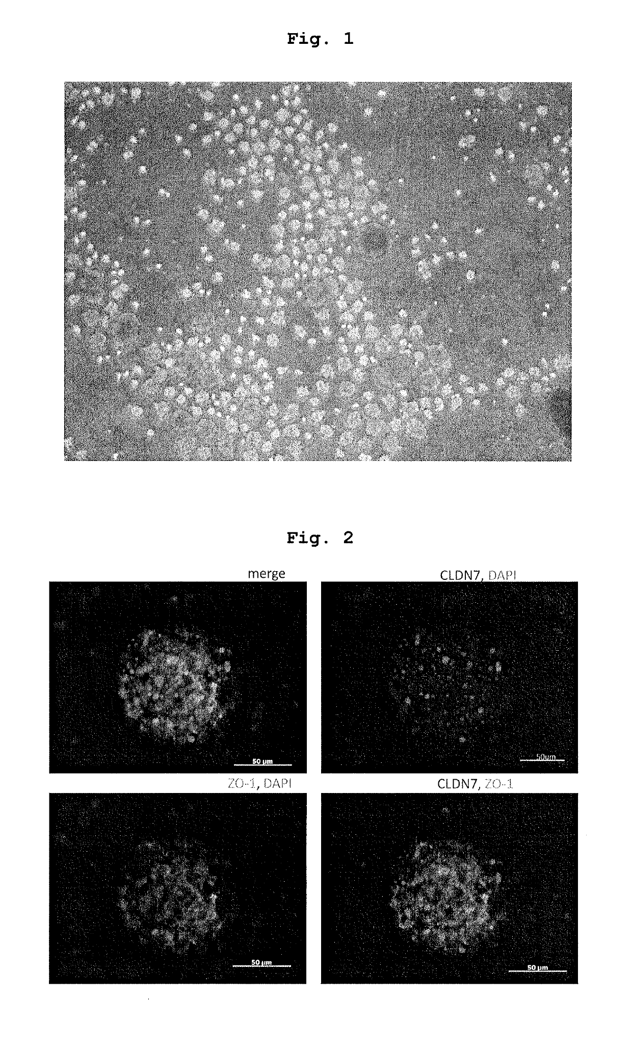 Method for producing therapeutic corneal endothelial substitute cell sphere