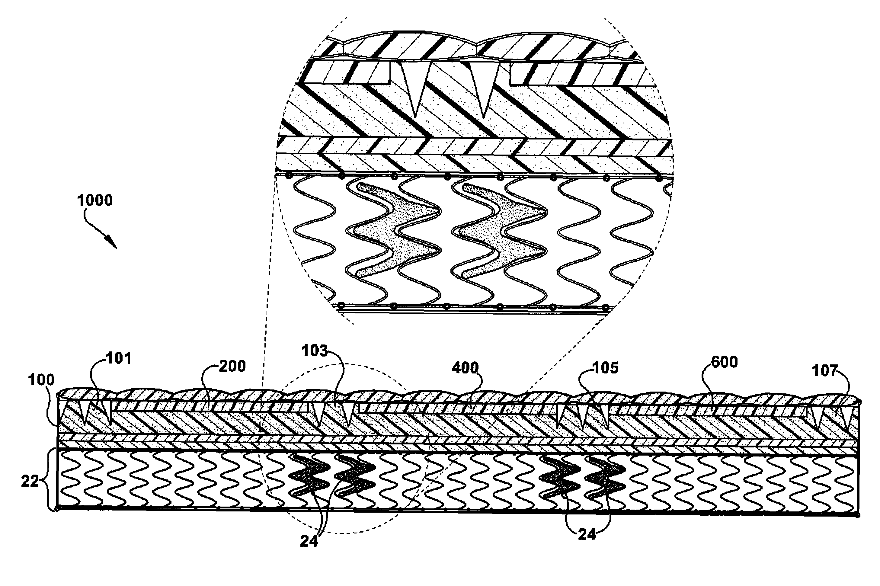 Pressure dispersion support systems