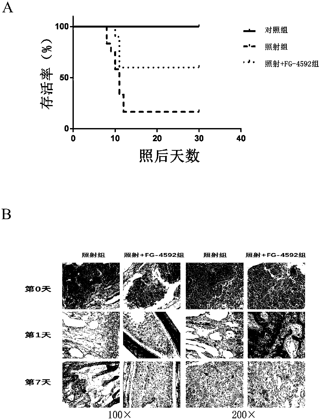 Application of FG-4592 to preparation of drug for preventing acute radiation bone marrow injury