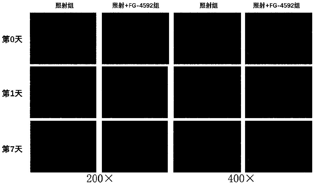 Application of FG-4592 to preparation of drug for preventing acute radiation bone marrow injury