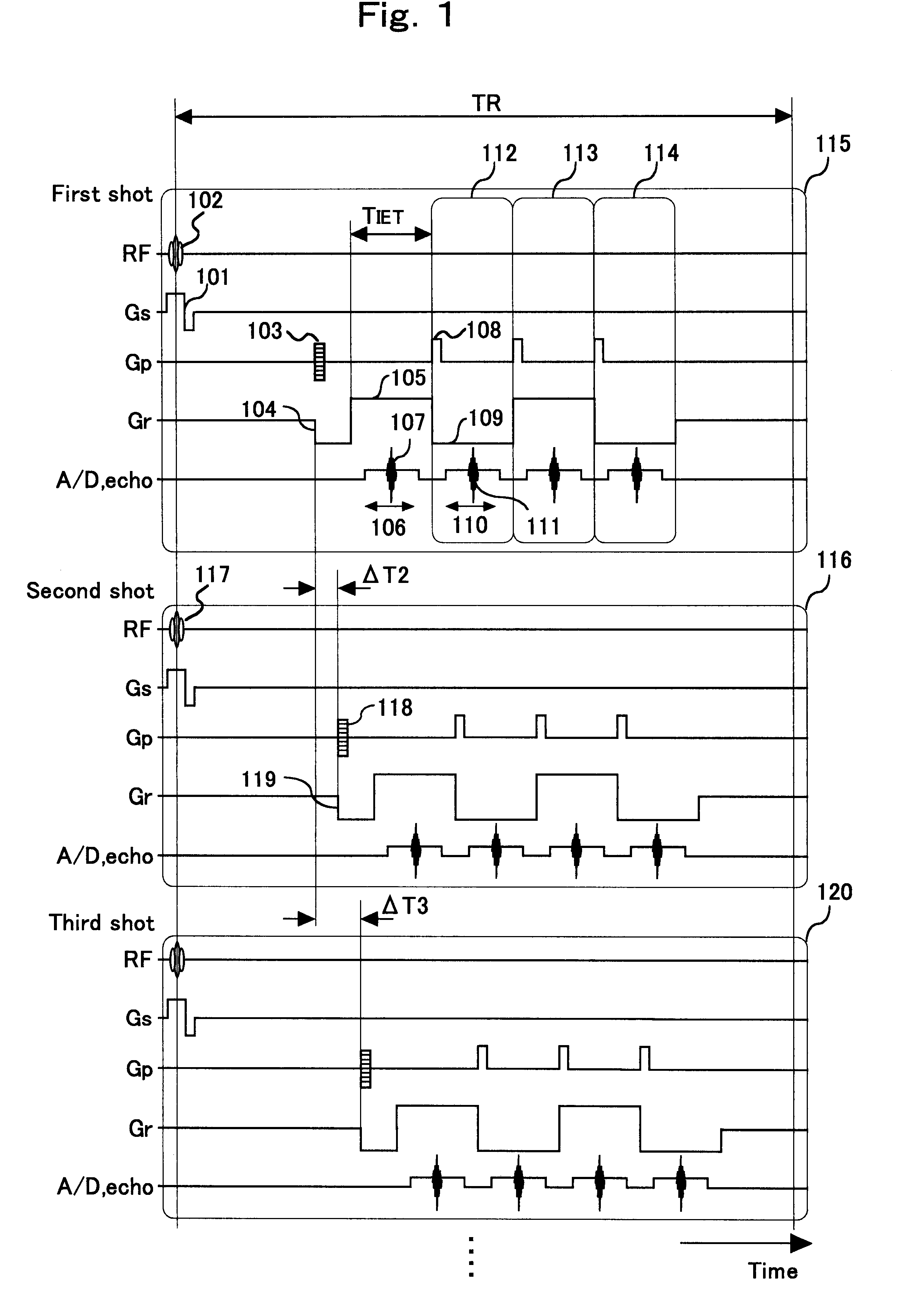 Magnetic resonance imaging method and device