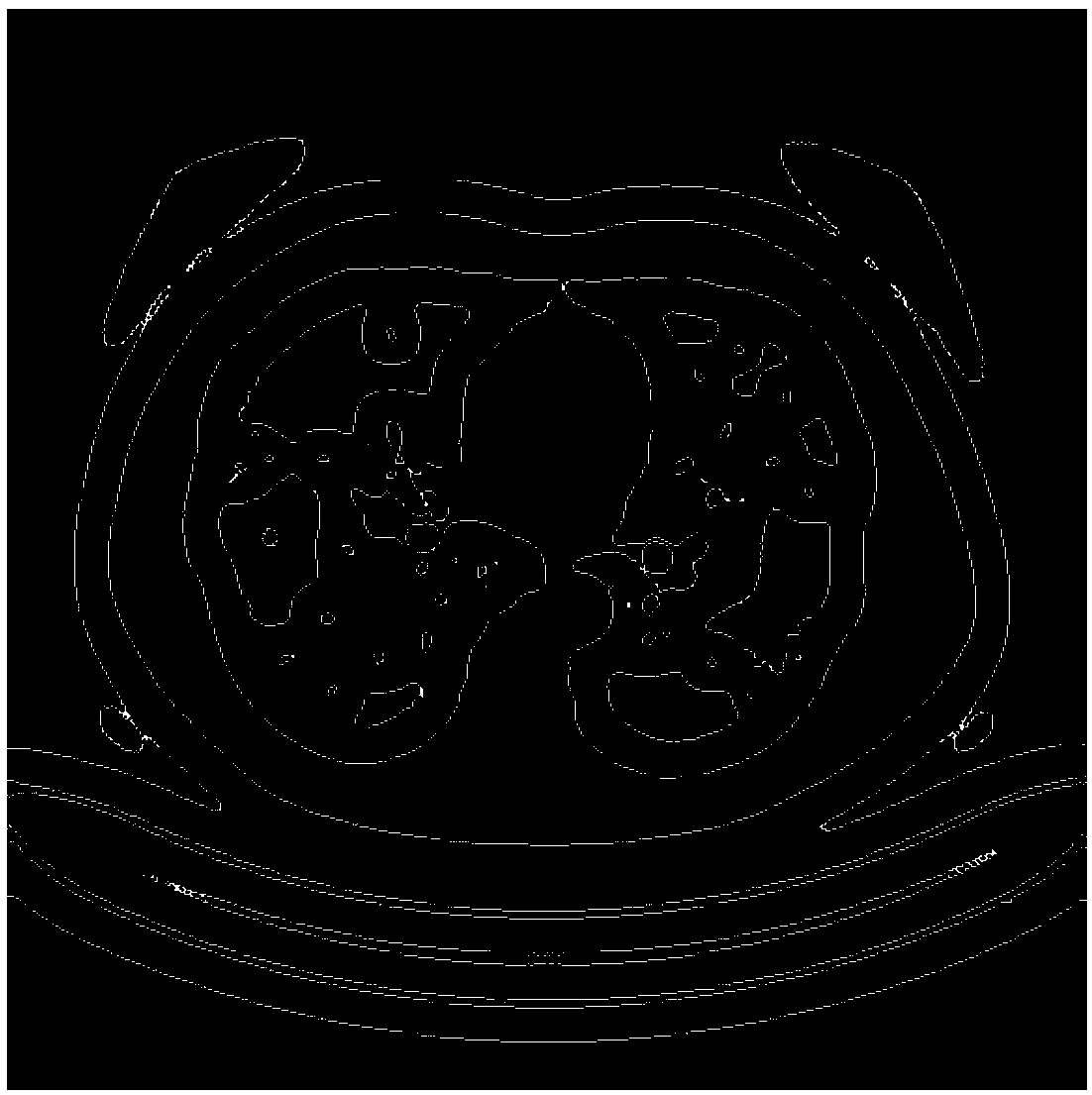 Image segmentation method of lung tissue on CT chest radiography based on level set