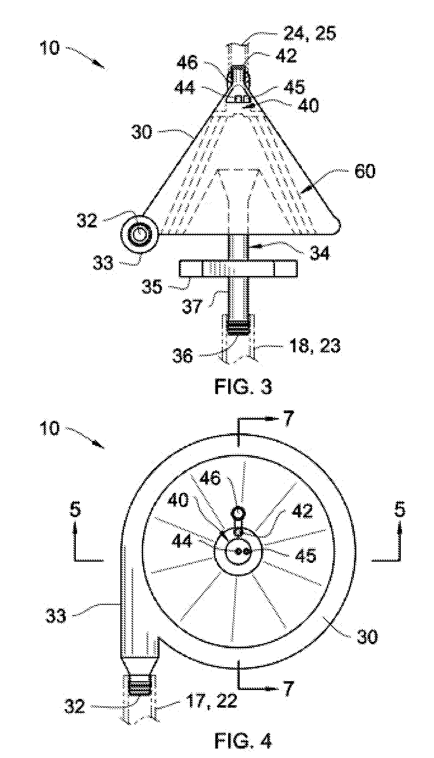 Extracorporeal Blood Filter System