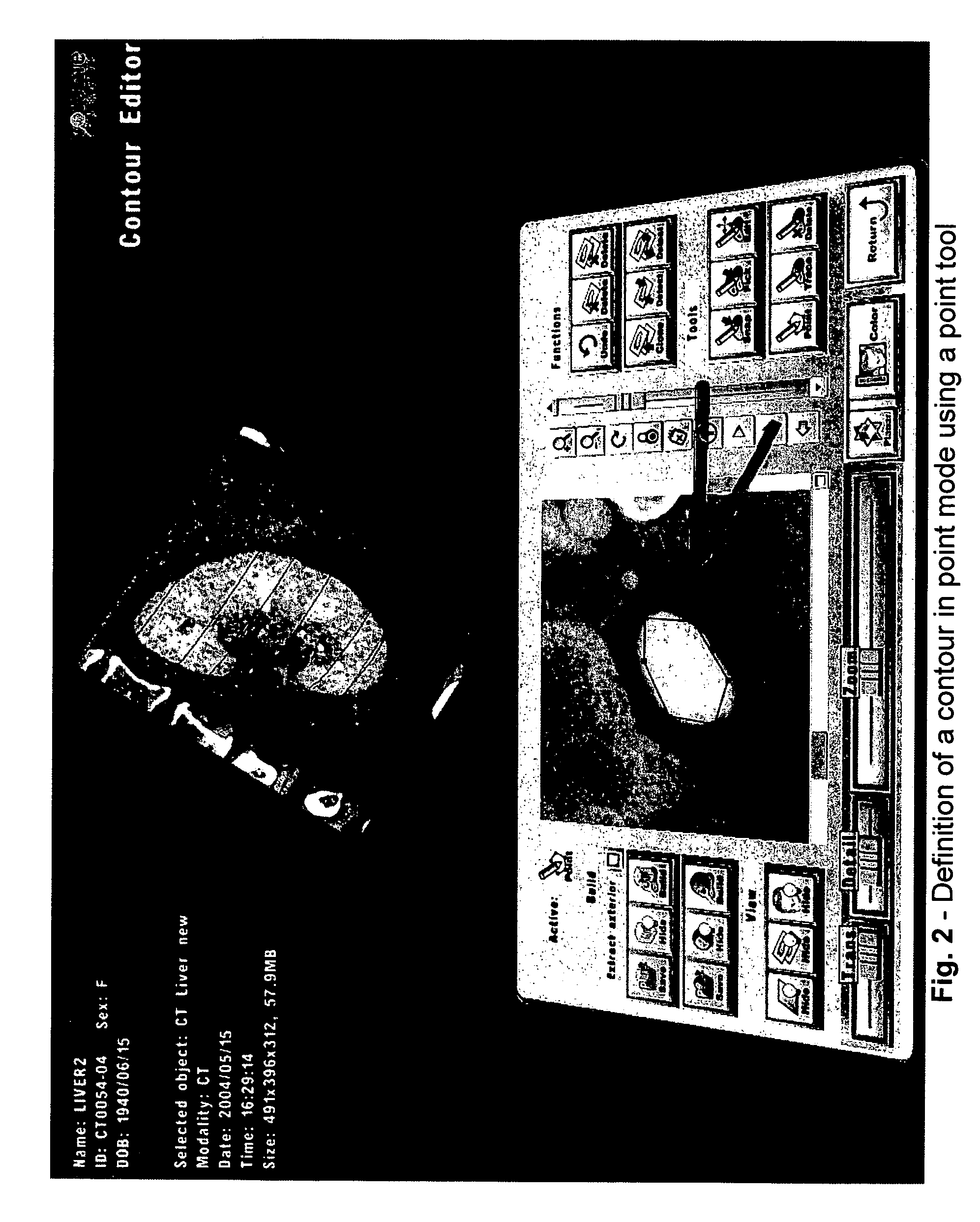 Systems and methods for segmentation of volumetric objects by contour definition using a 2D interface integrated within a 3D virtual environment ("integrated contour editor")