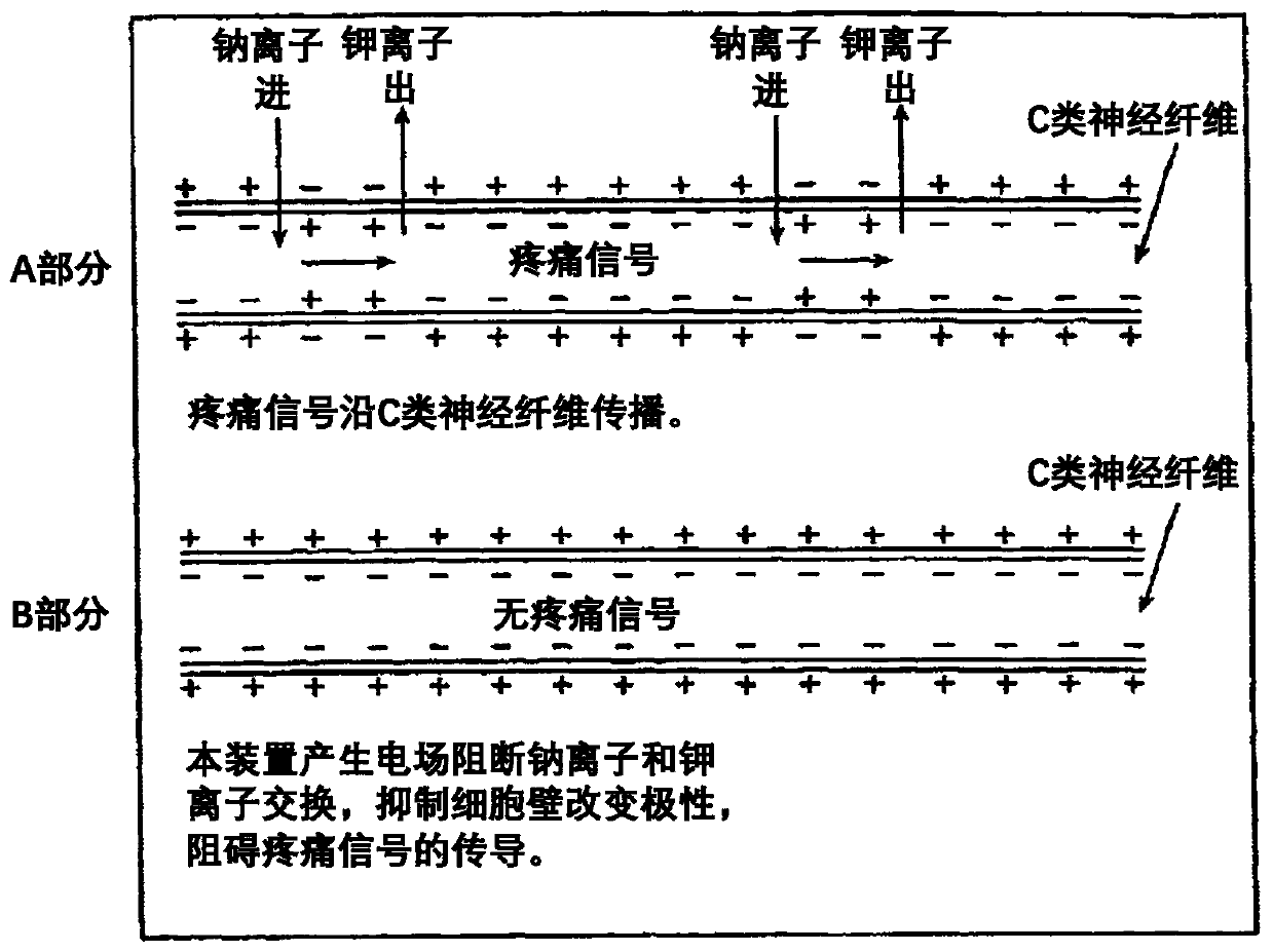 High-frequency sinusoidal wave electrotherapy system