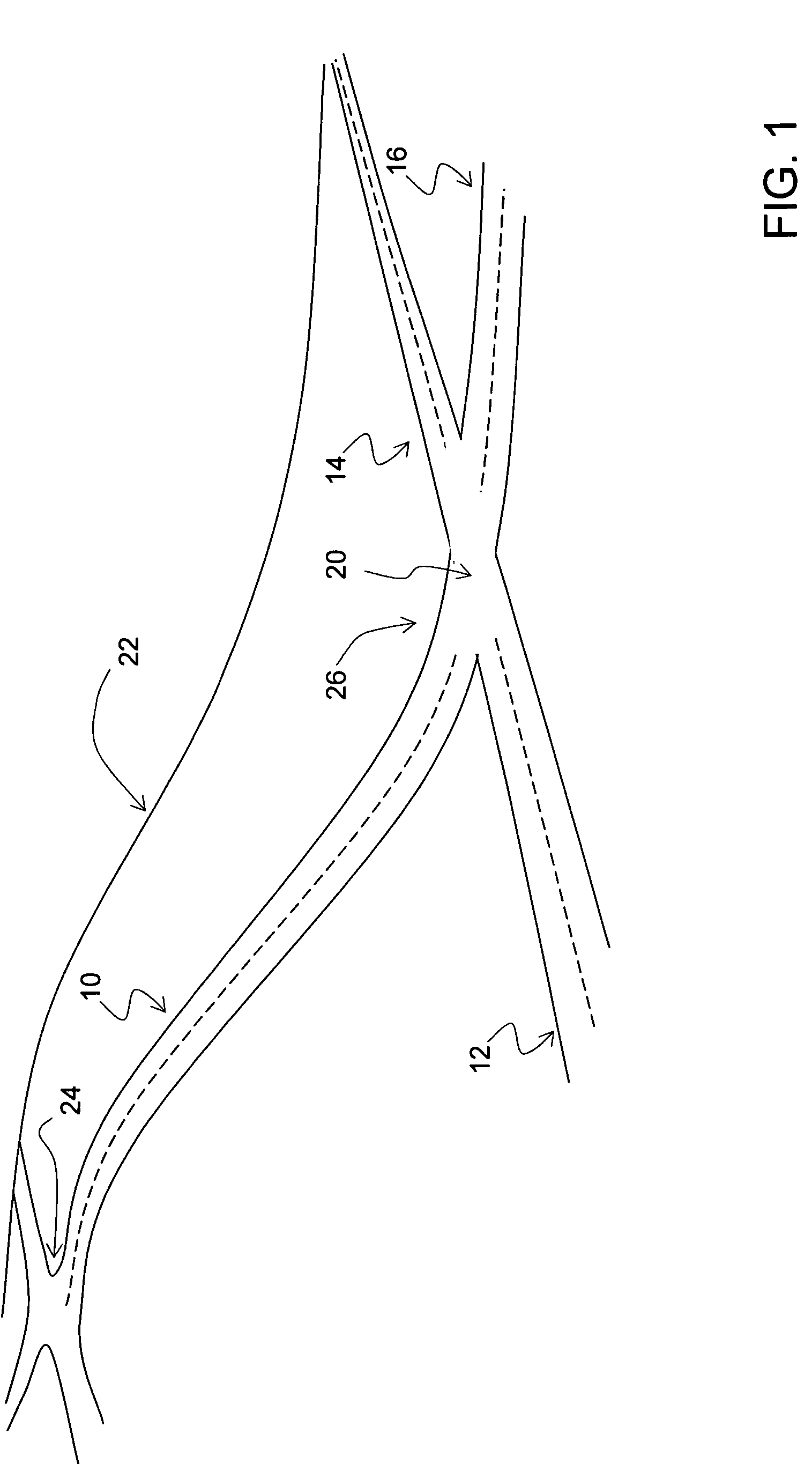 Data mining in a digital map database to identify intersections located at hill bottoms and enabling precautionary actions in a vehicle