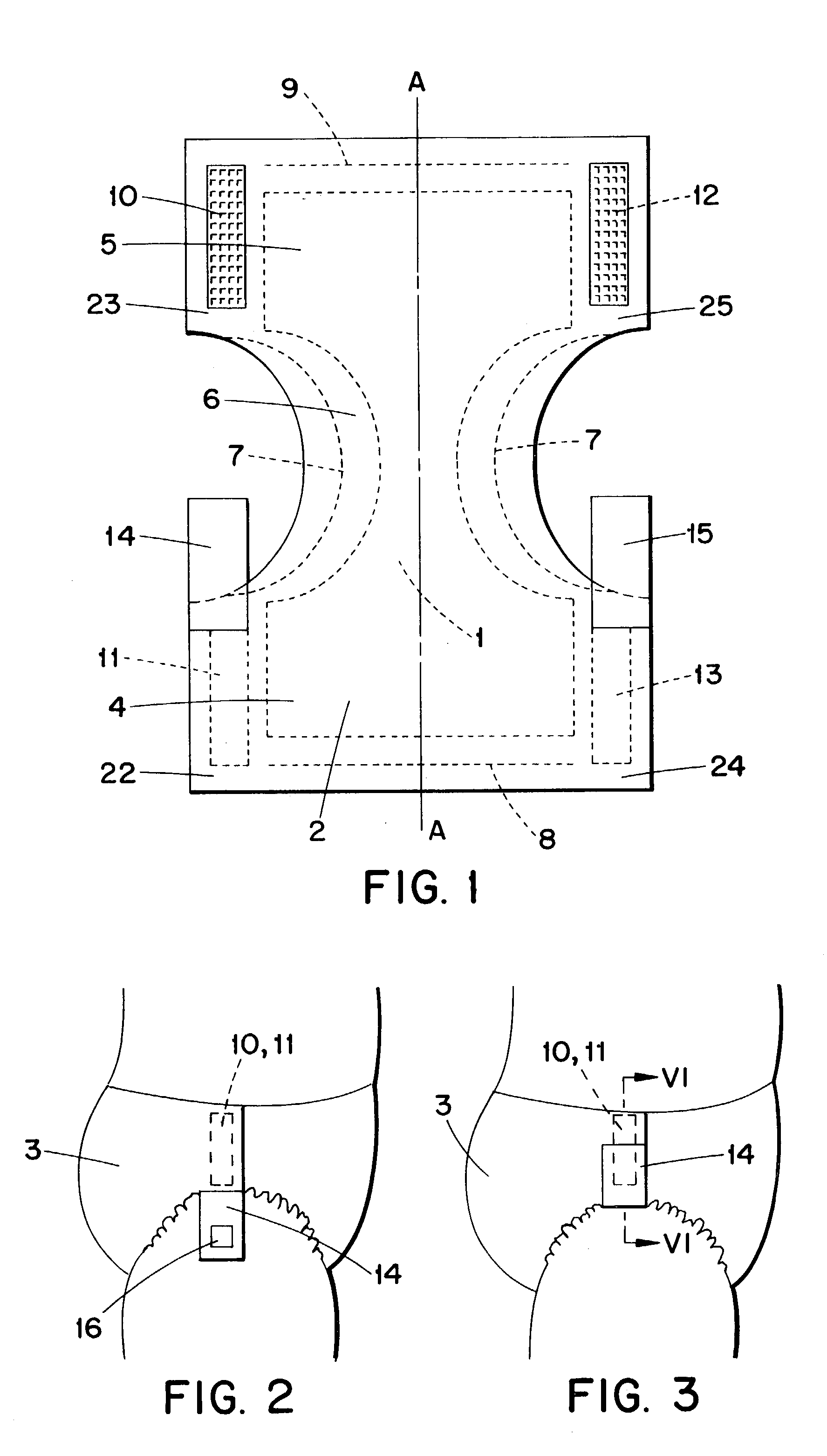 Diaper having refastenable side-bridging joins